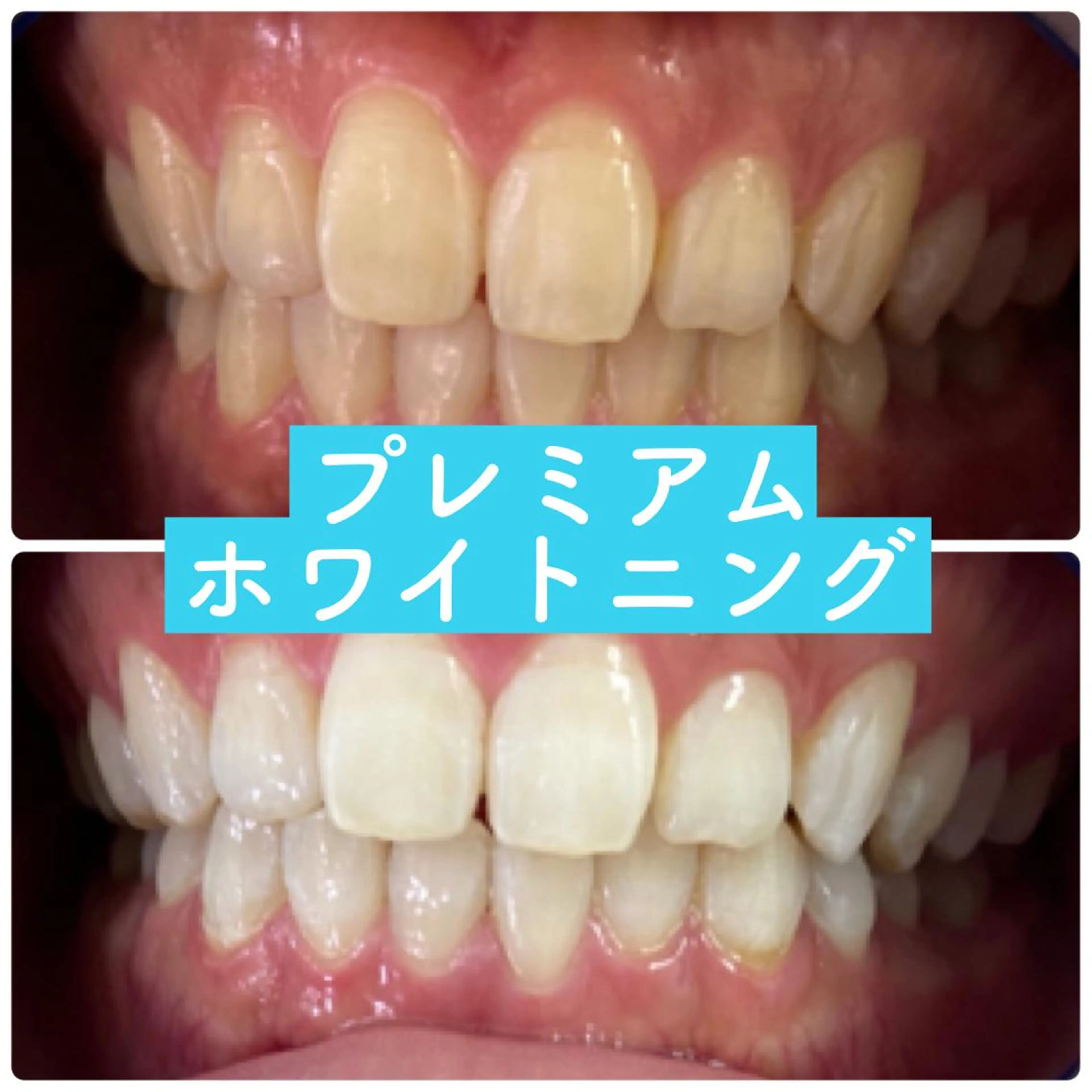 PLATINUM Beauty 横浜店所属・ホワイトニングルーム 横浜店のその他イメージ