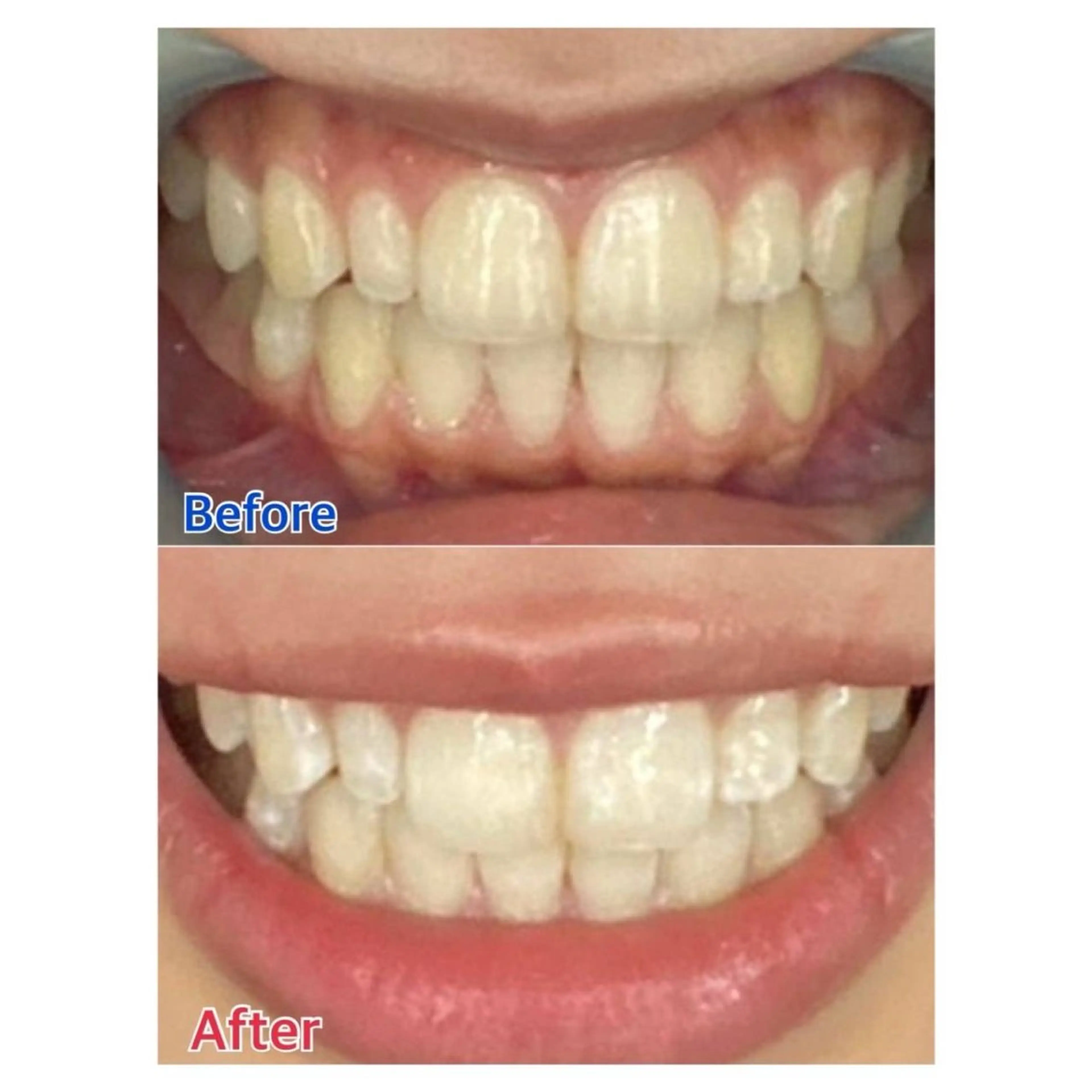 MBEAUTYSALON 千葉店・京成大久保所属・Melty 輝のその他イメージ