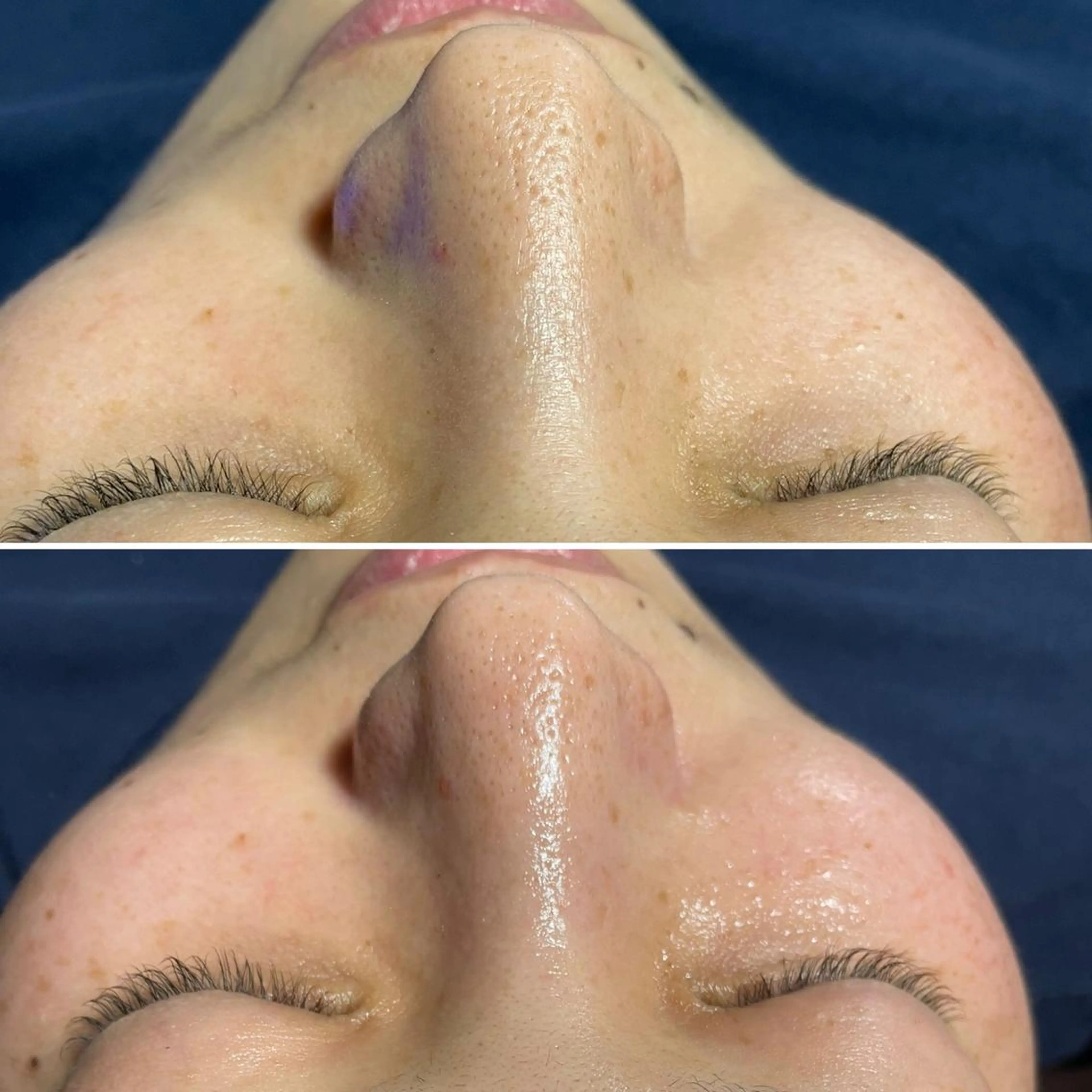 SESUNNY セサニー SEIRAのマツエク・マツパデザイン