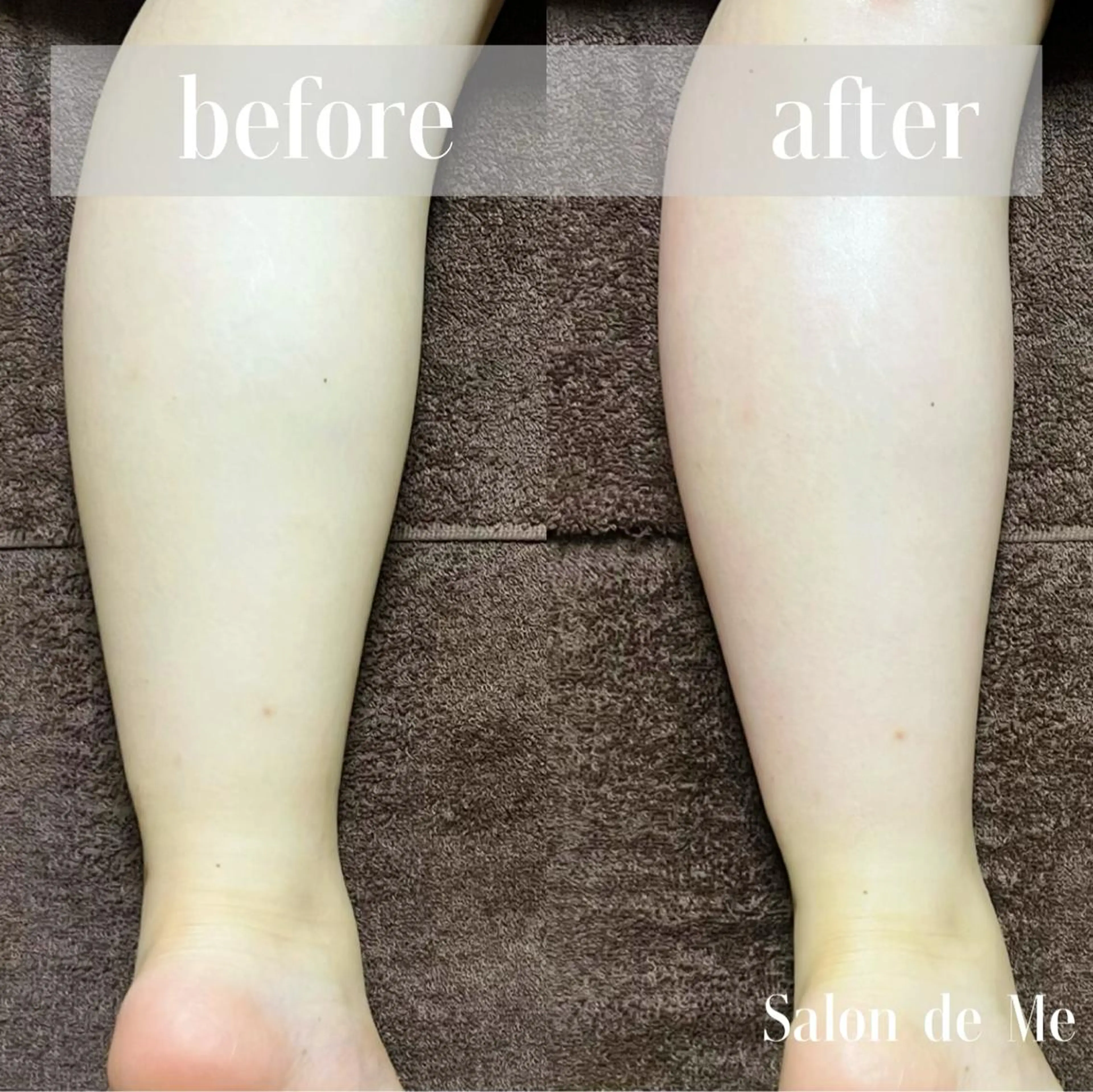 エステ Salon de Me所属・💫Salon de Me💫予約停止中のエステ・リラクイメージ