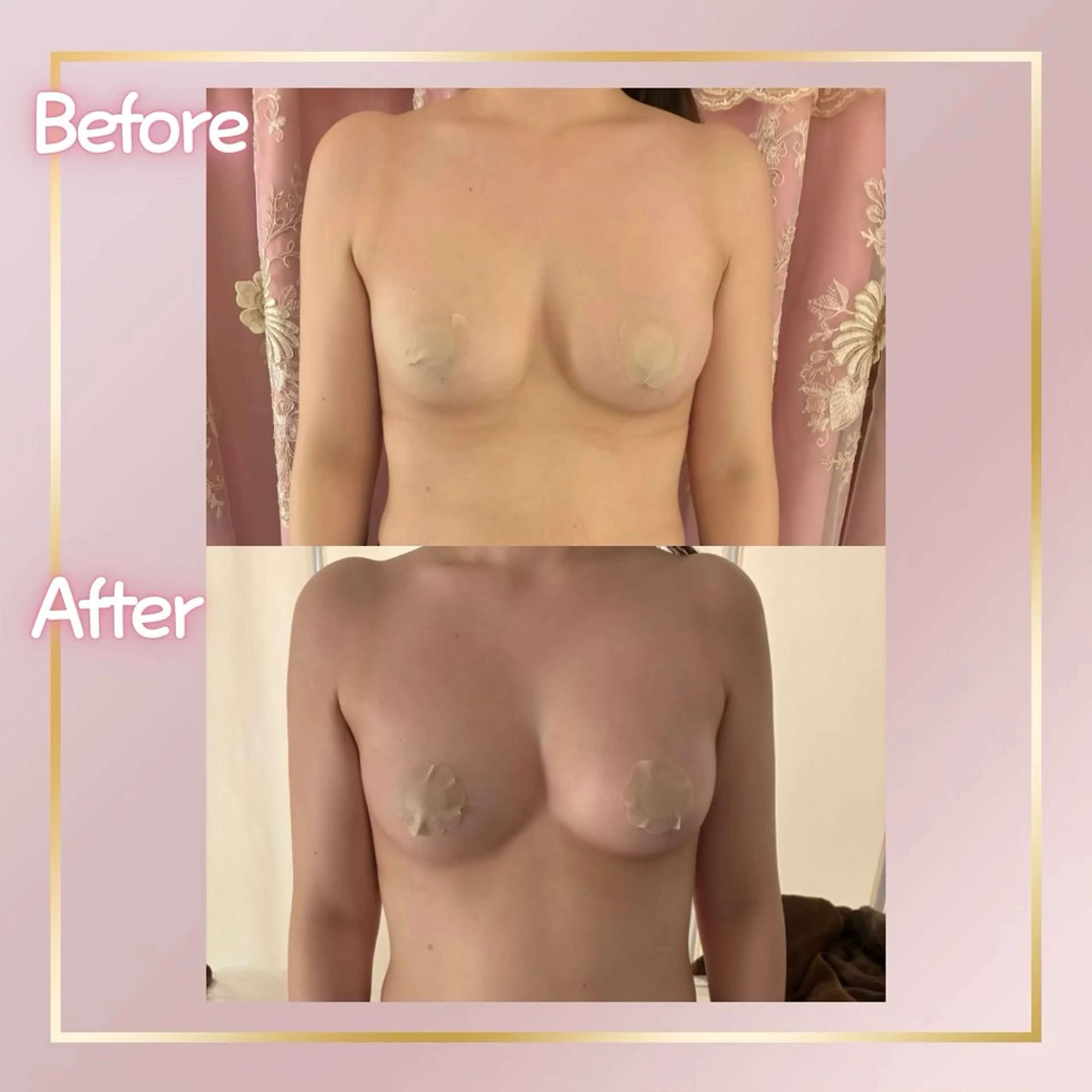 その他 ROSALIA 【バストアップ、痩身、毛穴洗浄】所属・【24時まで営業】 バストアップ専門店のエステ・リラクイメージ