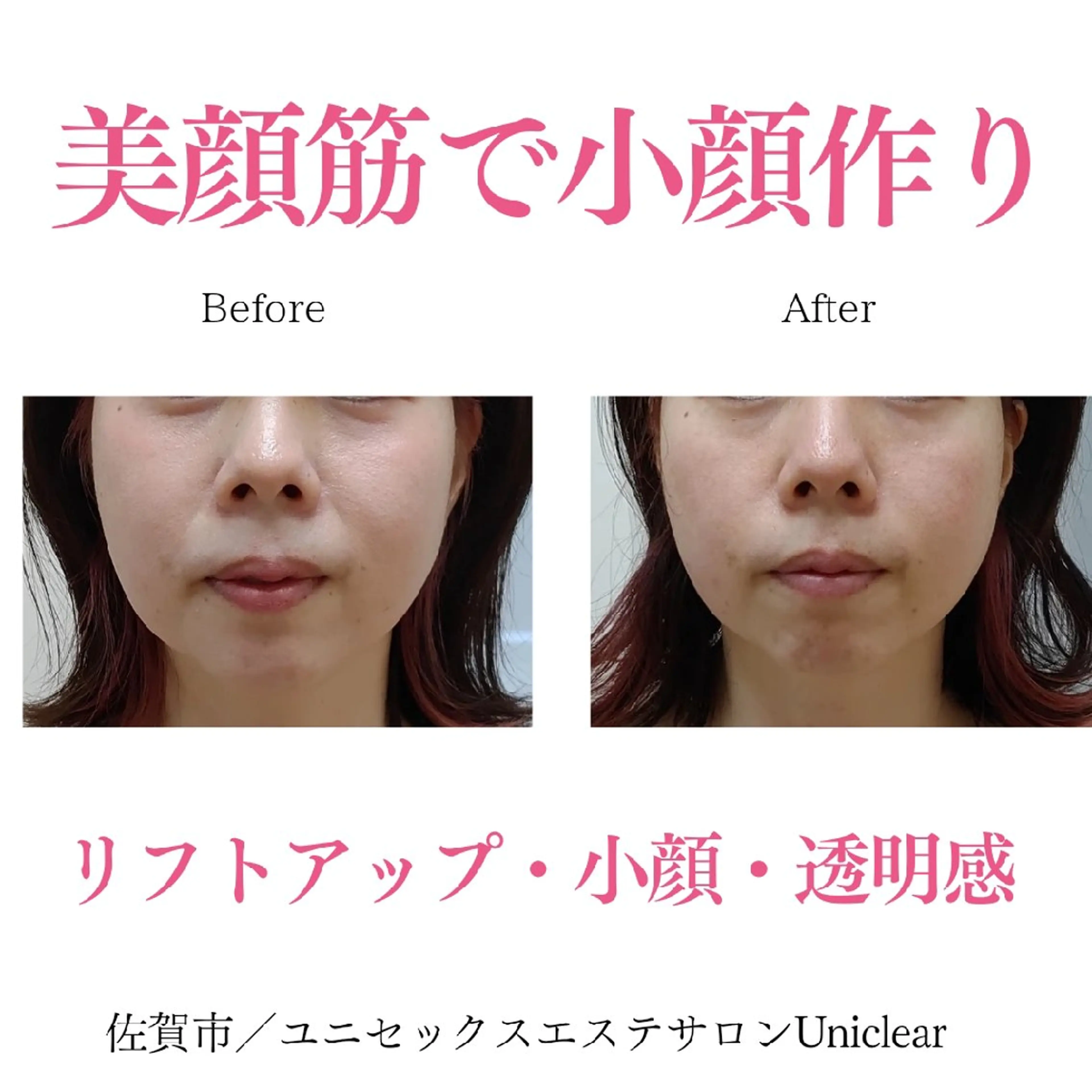 ユニセックスエステサロンUniclear所属・痩身&フェイシャル Uniclearのエステ・リラクイメージ