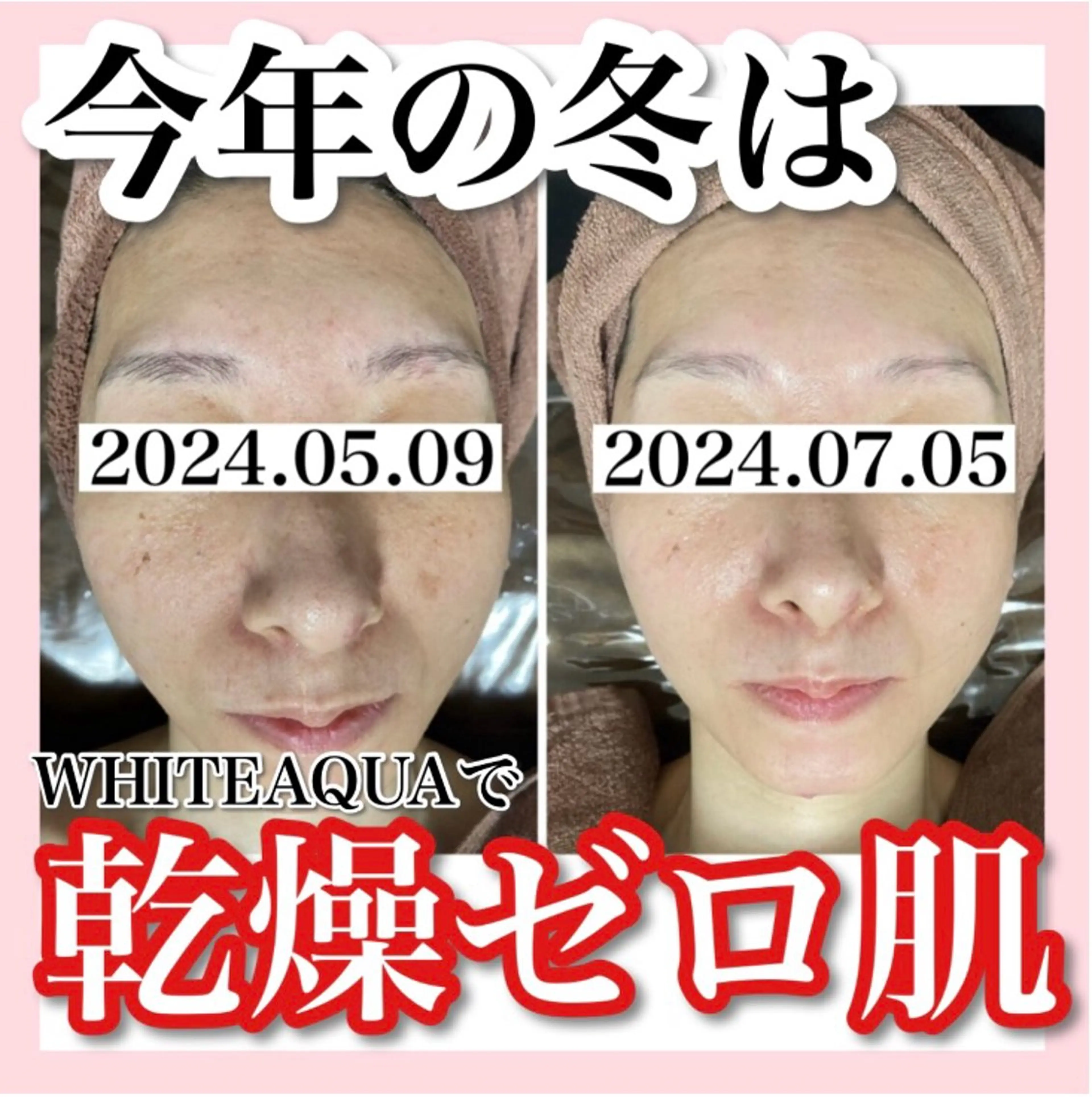 脱毛・ハーブピーリング専門サロン bida m所属・🌷あいり 🌷のエステ・リラクイメージ