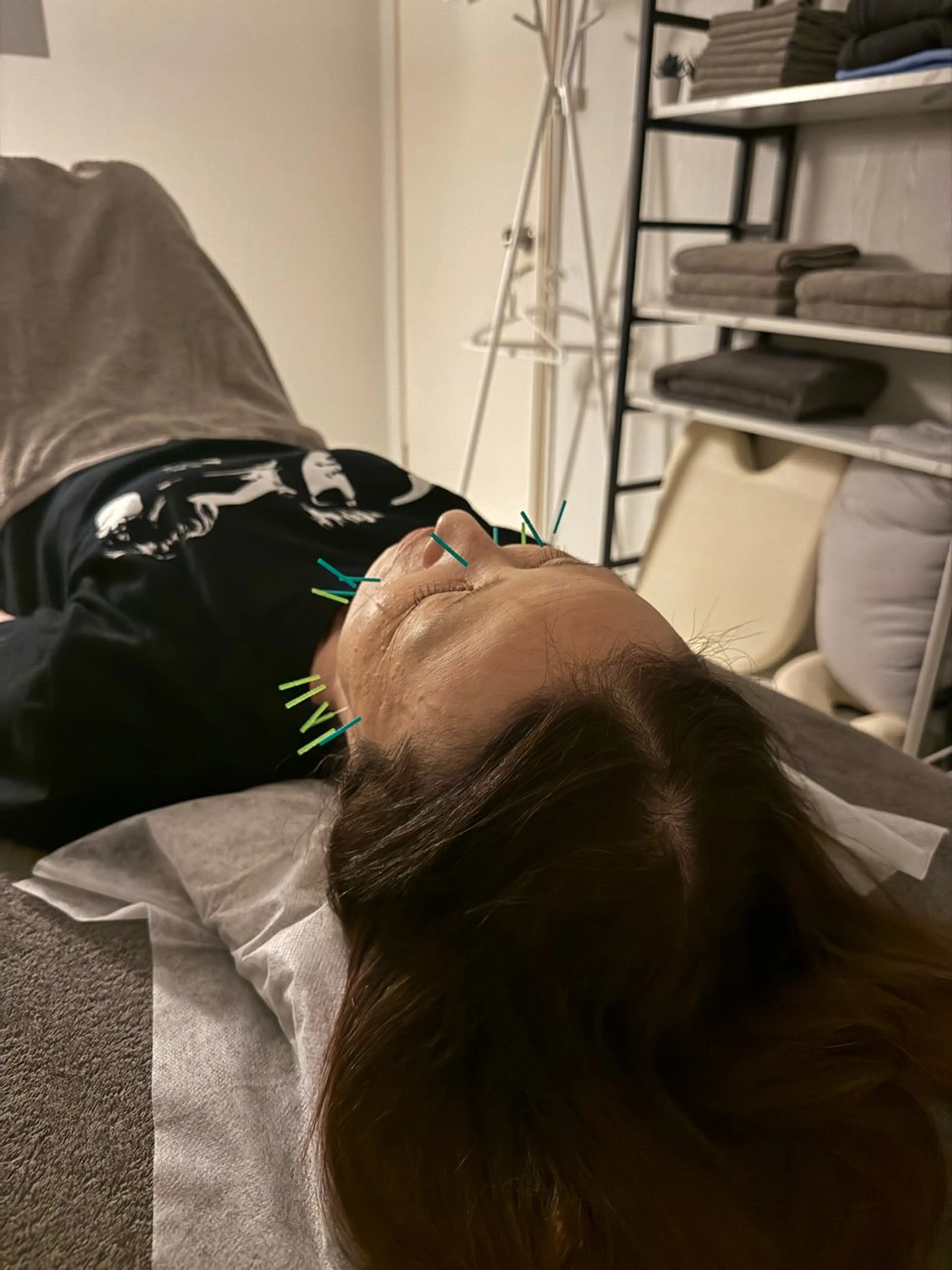 エステ リラク 美容鍼×小顔矯正 ×美容整体　浜川泰仁のエステ・リラクイメージ