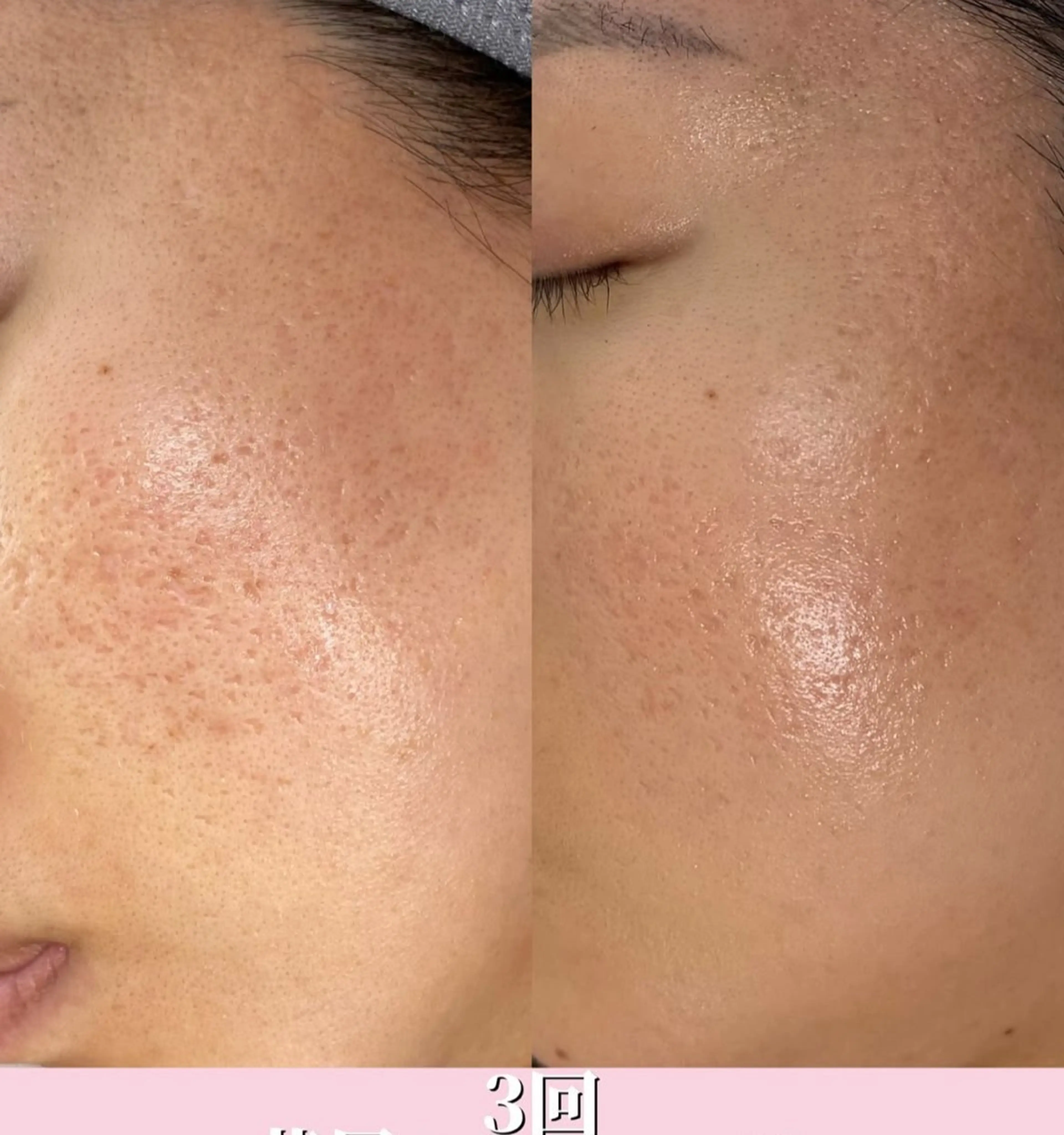 Blooming所属・LOUISE. ／肌質・頭皮のエステ・リラクイメージ