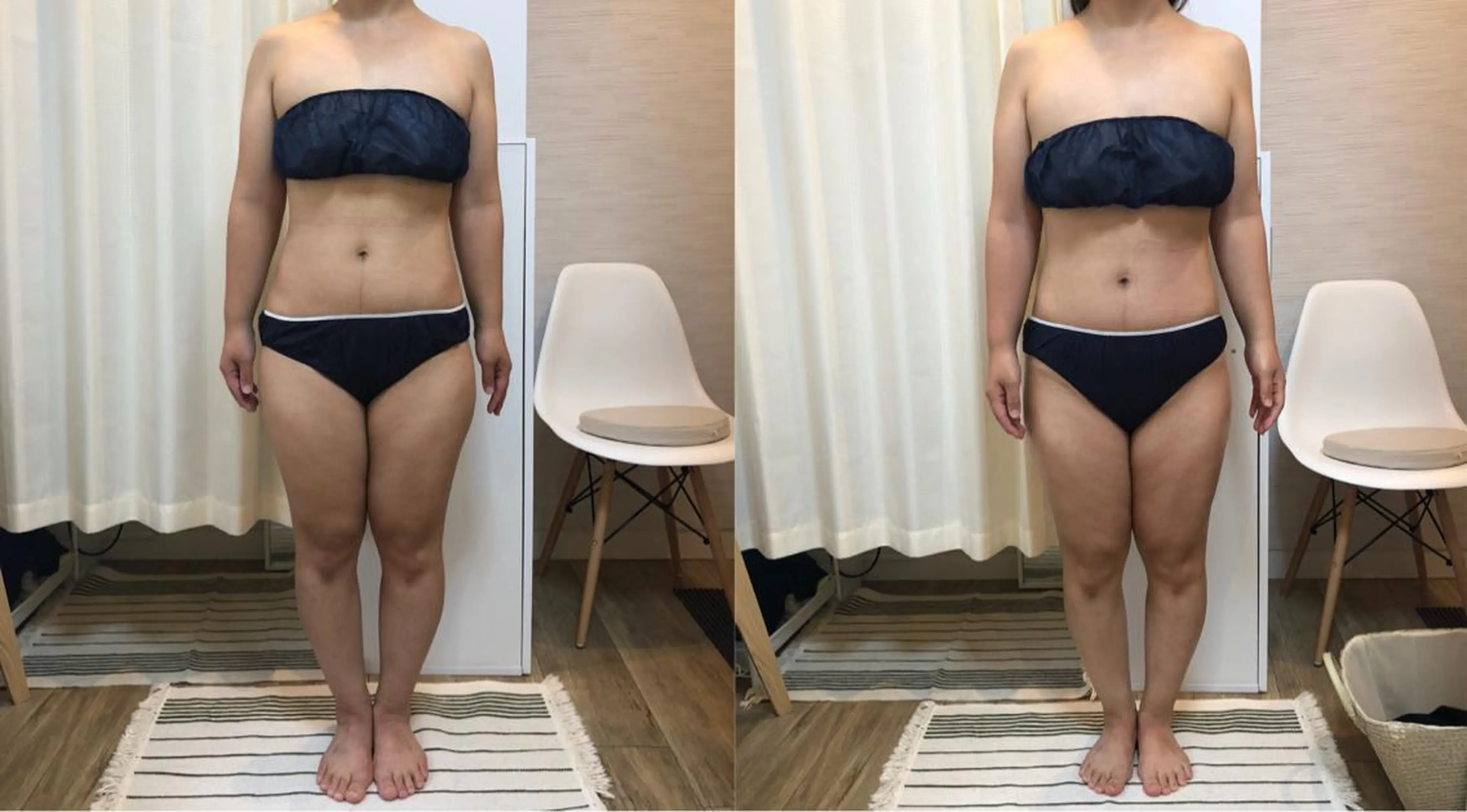 脱毛｜ピーリング ROOM.Sのエステ・リラクイメージ