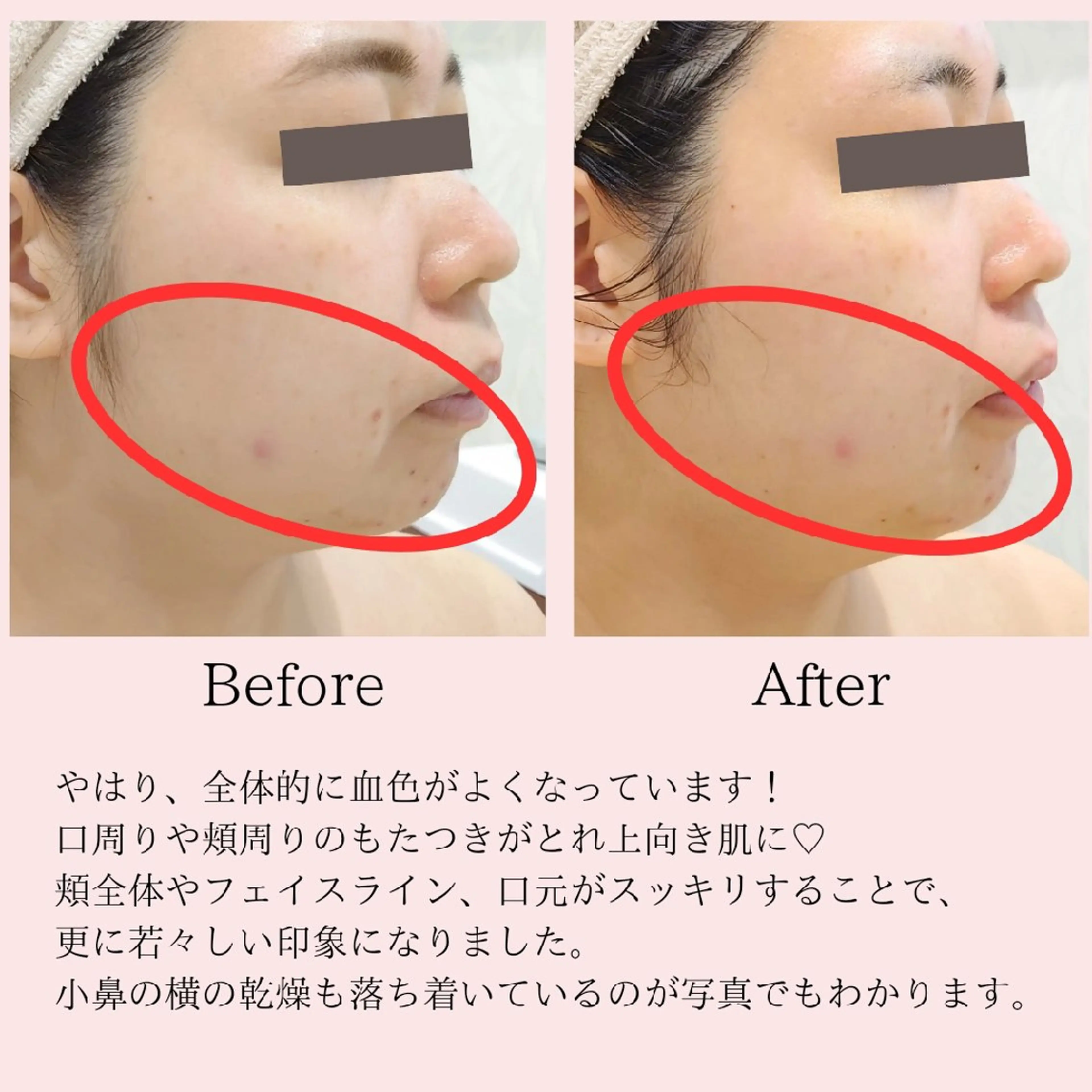 エステ PRETTIEST SHINE所属・フェイシャル/ボディ /ブライダル山田浩子のエステ・リラクイメージ