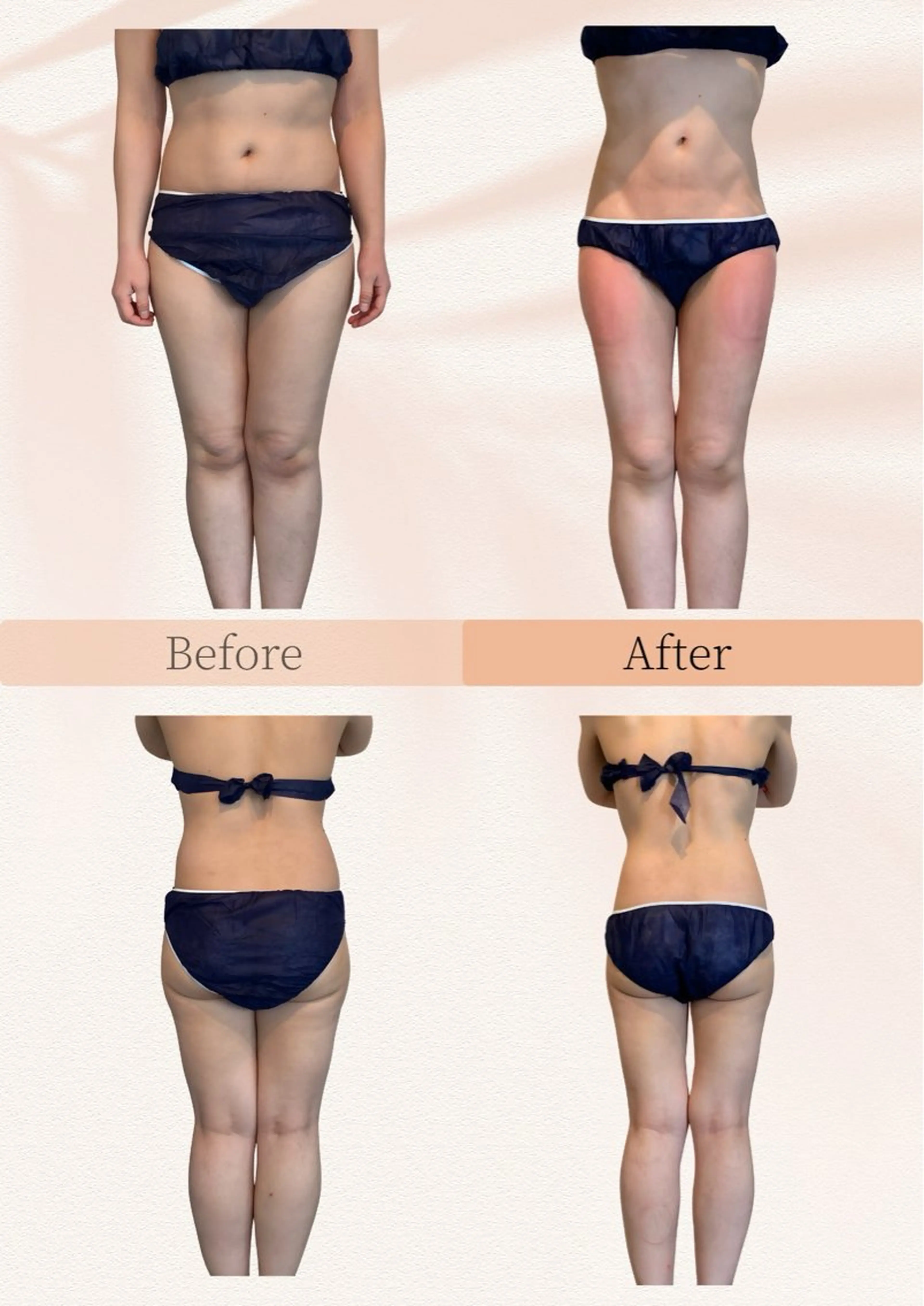 綺麗のひみつ グランプリ受賞店のエステ・リラクイメージ