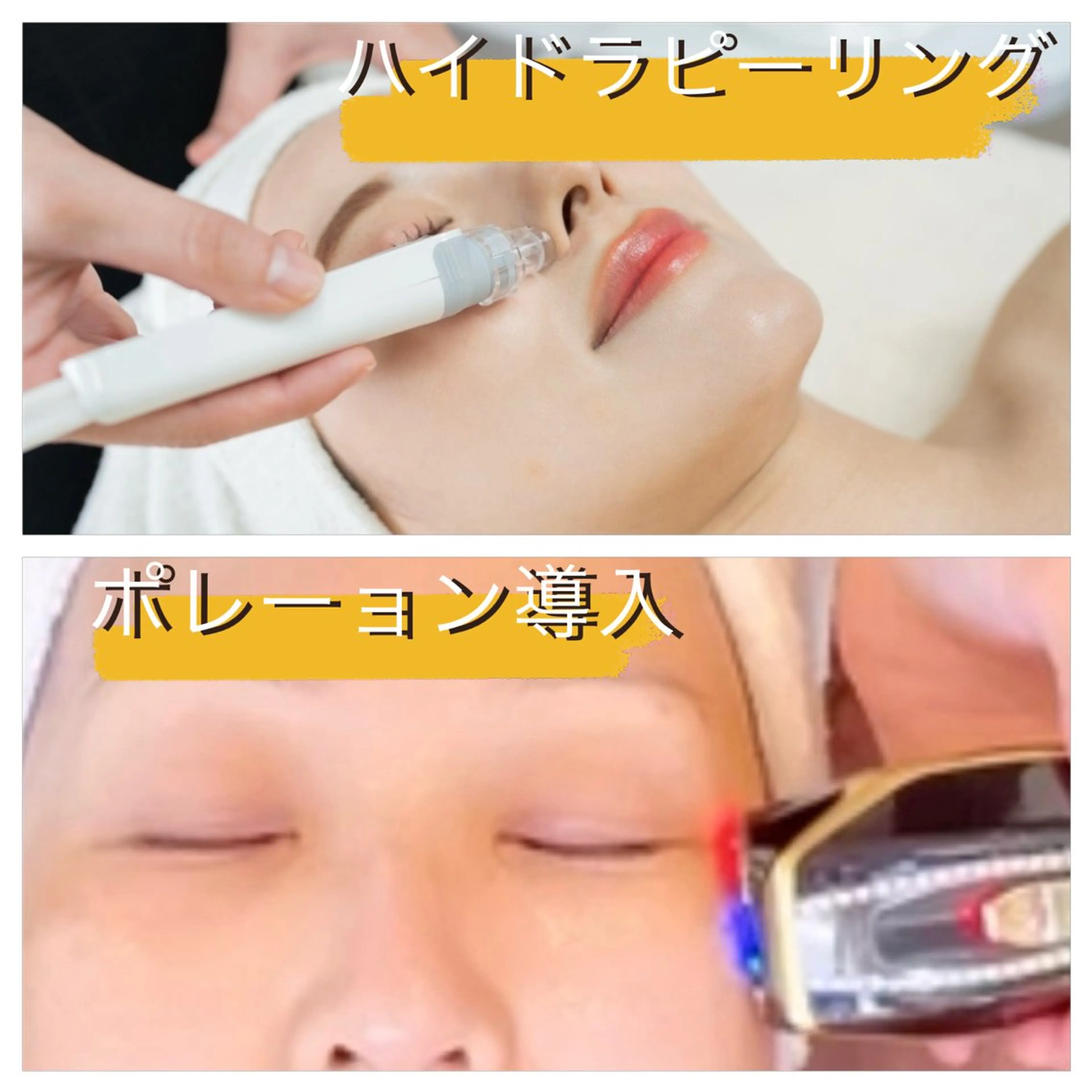 肌質改善エステ chiffonのエステ・リラクイメージ