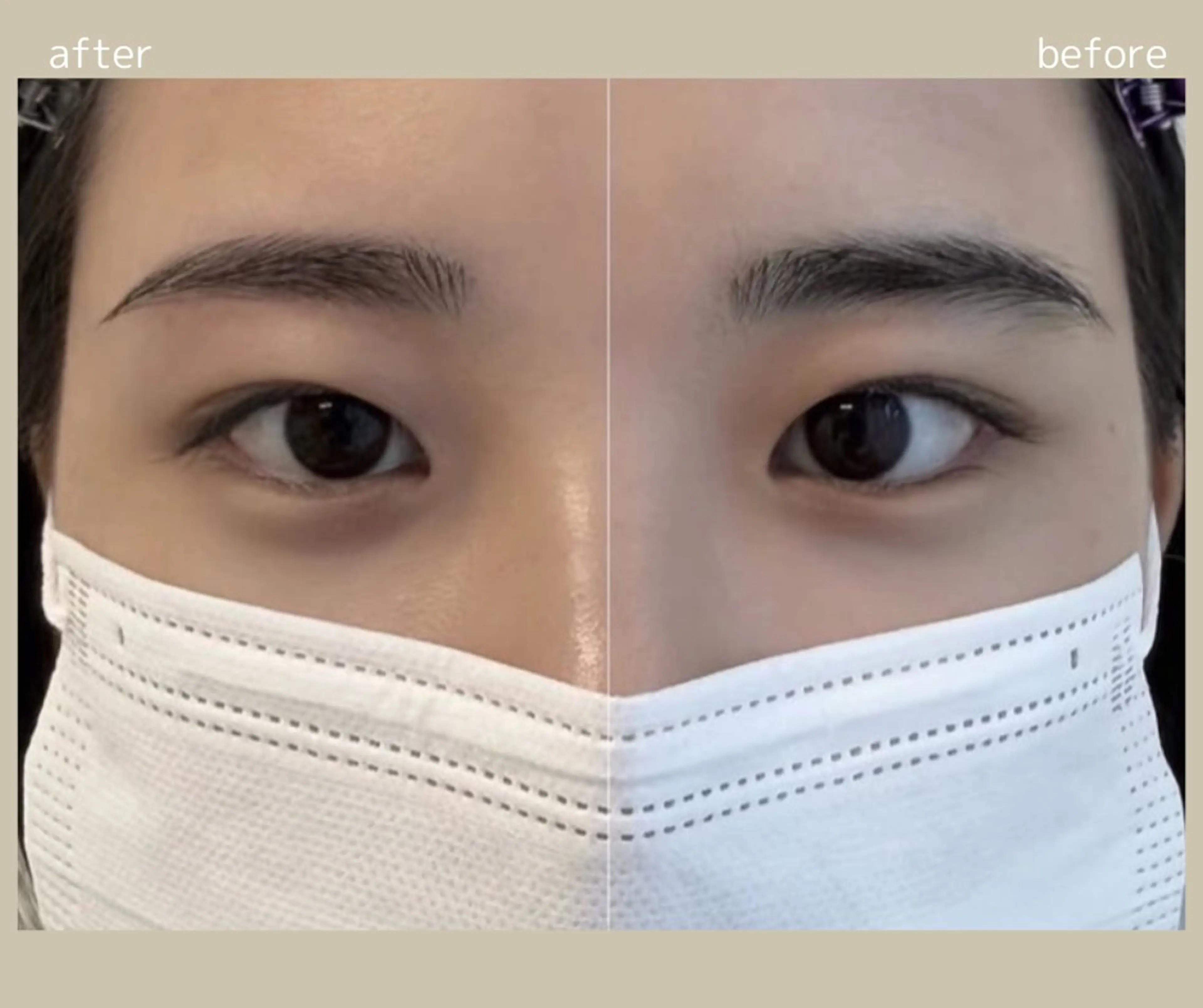 アイブロウ 眠りの森/脱毛眉毛/ マッサージ/RINAのエステ・リラクイメージ