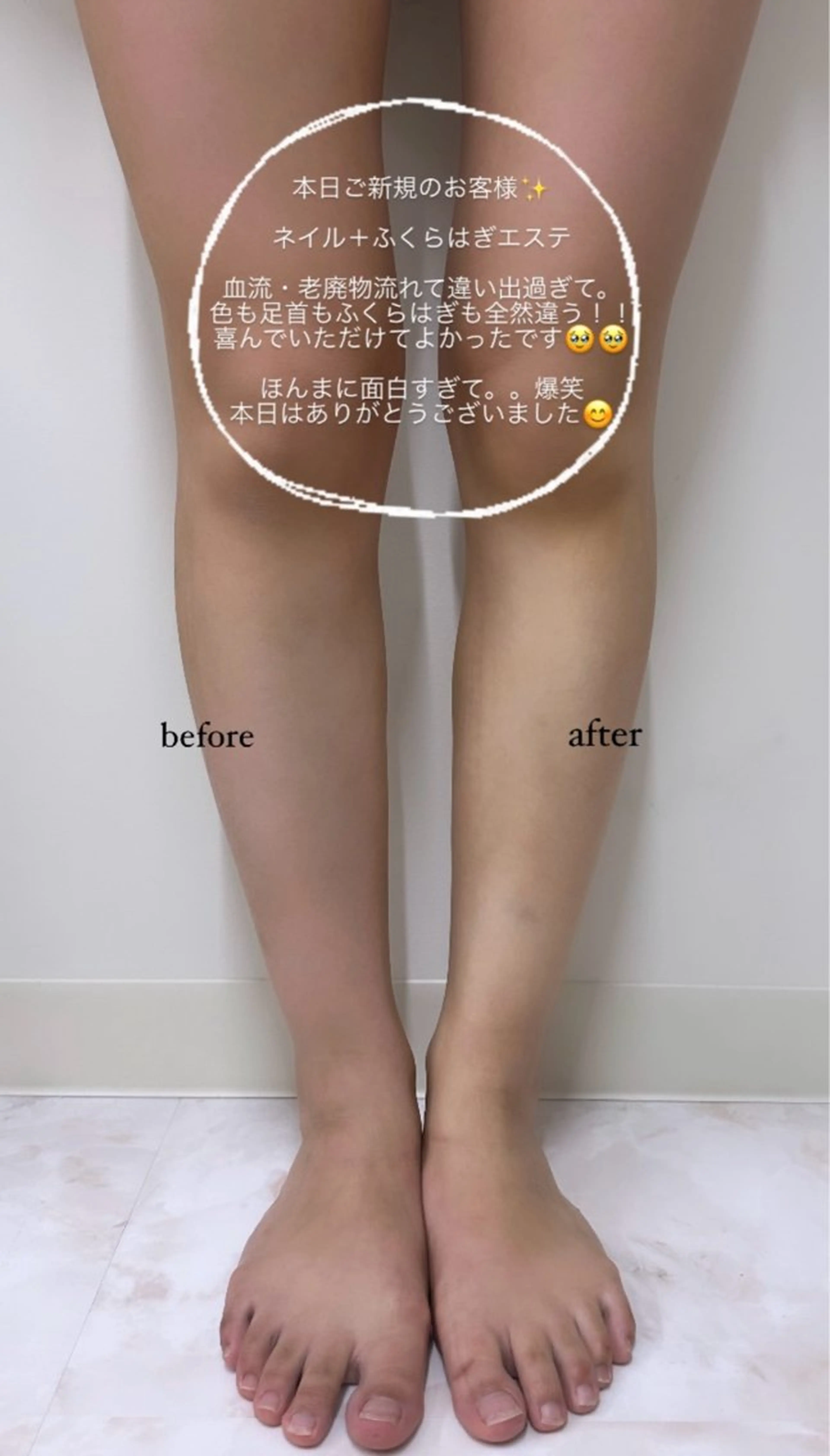 ネイル mignon nailのネイルデザイン