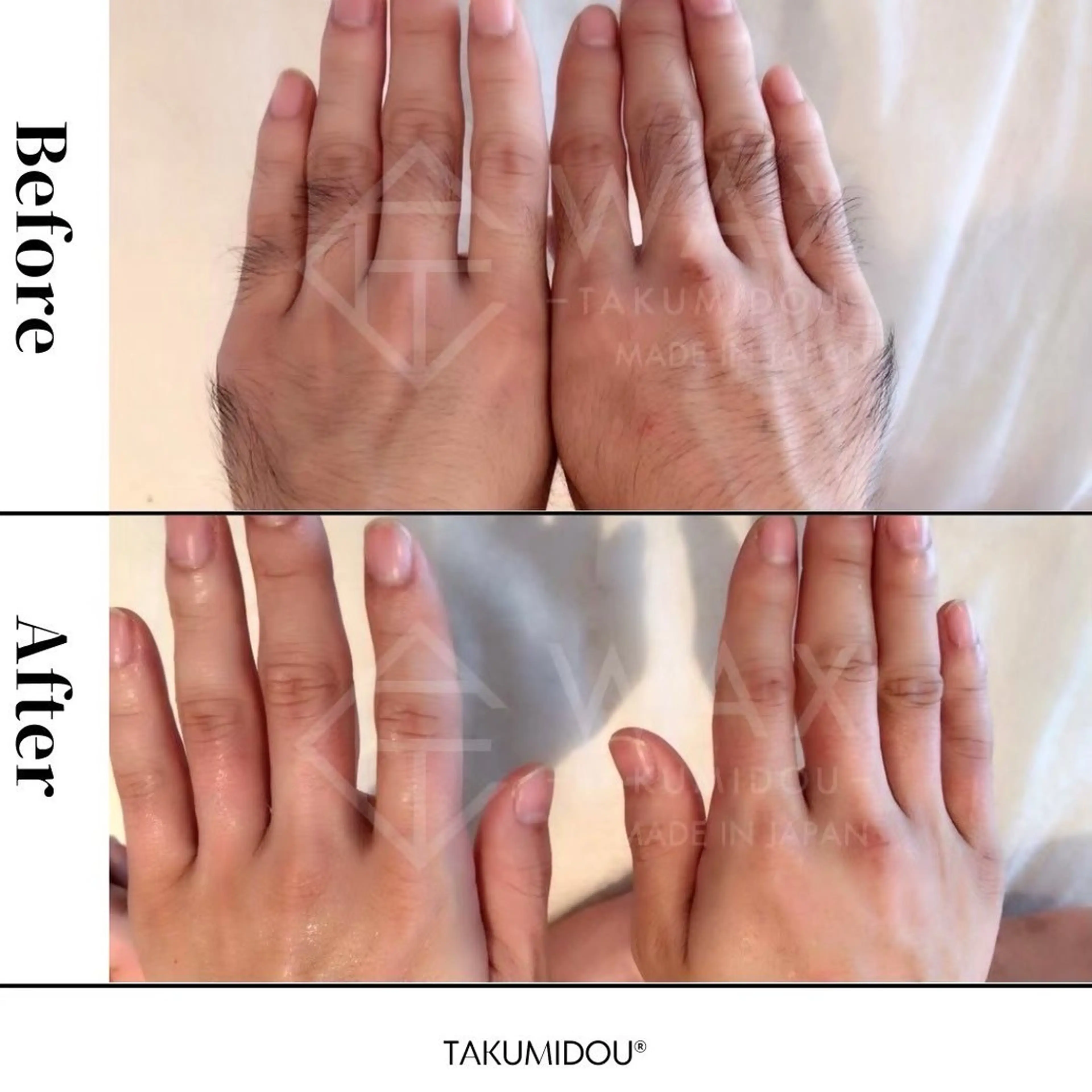 JYUNESU所属・眠れるワックス脱毛 ・銀座のエステ・リラクイメージ