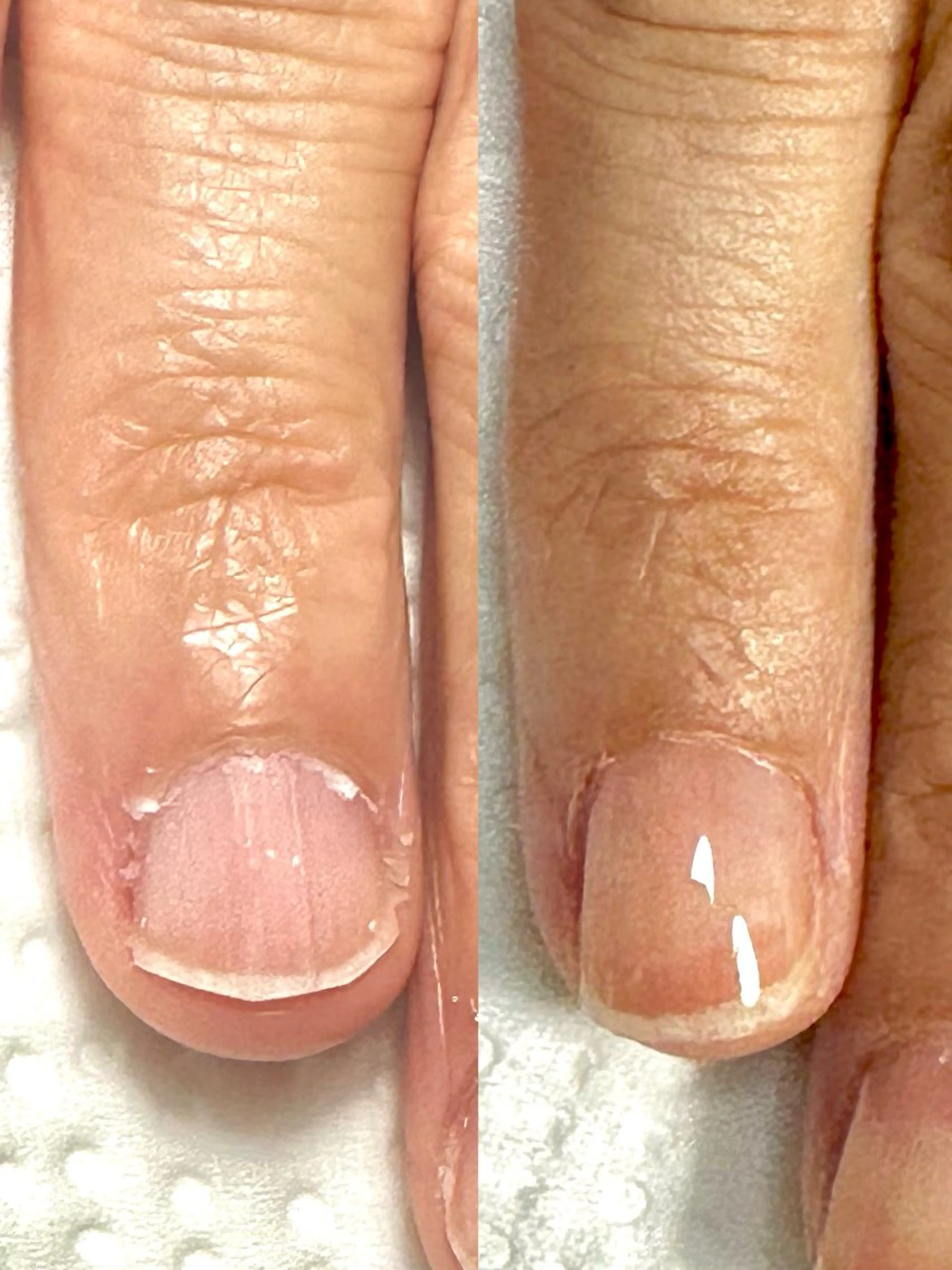 ネイル 自爪育成サロン ラムールのネイルデザイン