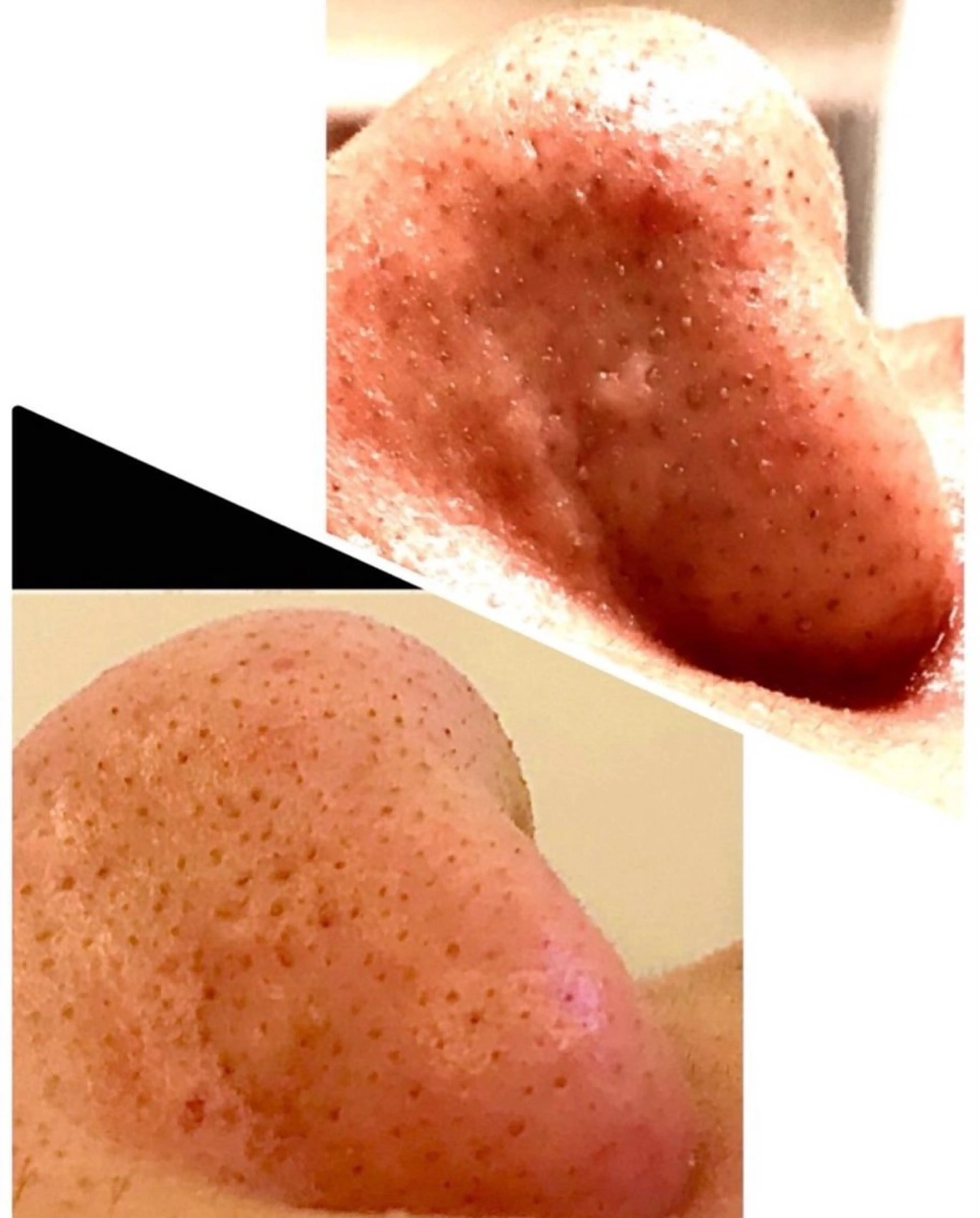 エステ リラク 肌質改善 KALANCHOEのエステ・リラクイメージ