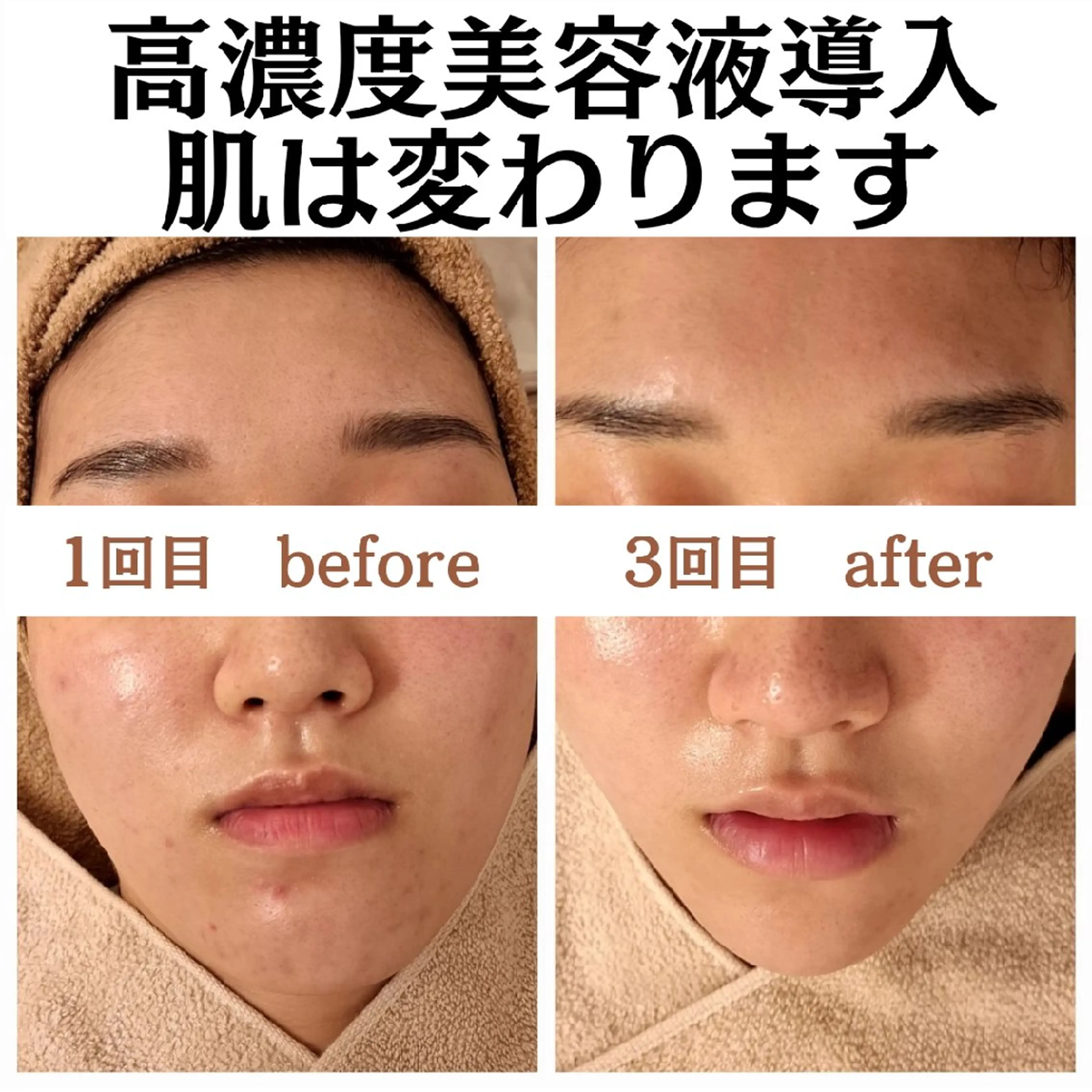 フェイシャル専門サロ ン ERINのエステ・リラクイメージ