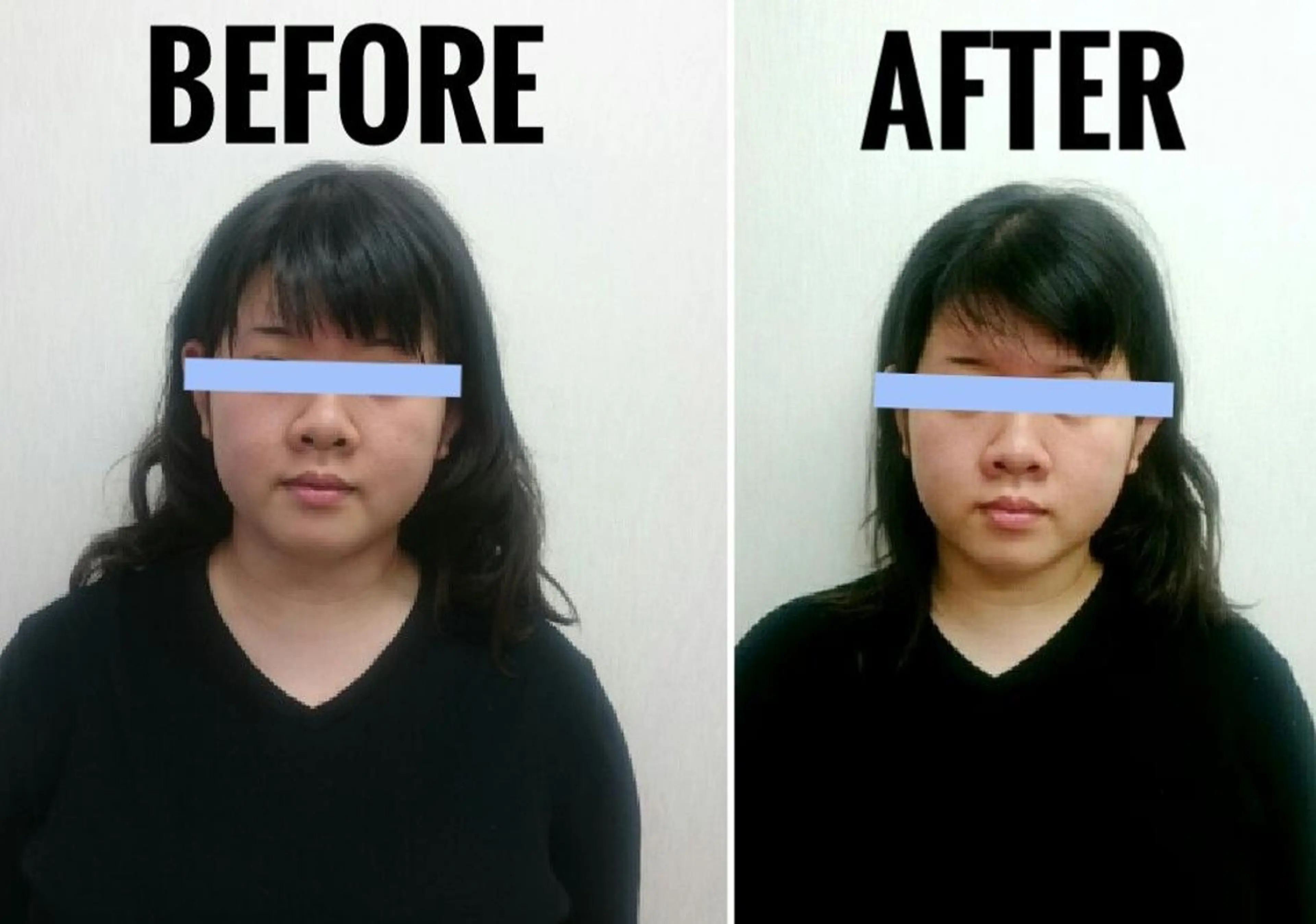 小顔矯正 頭痛専門のブライト整体 所属・ブライト整体 〜1人整体.完全予約のエステ・リラクイメージ