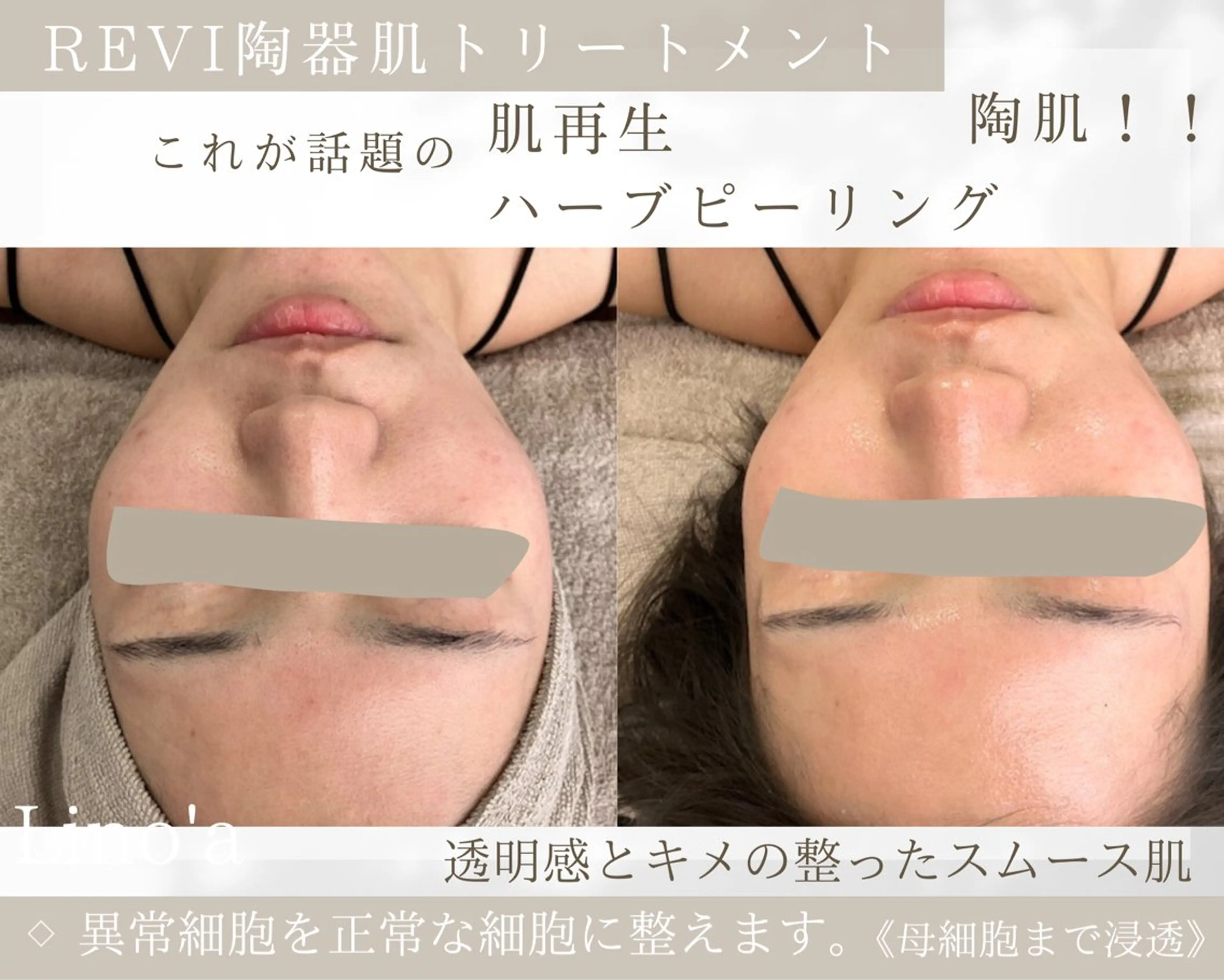 エステ リラク Salon💫 Lino'a柏店のエステ・リラクイメージ