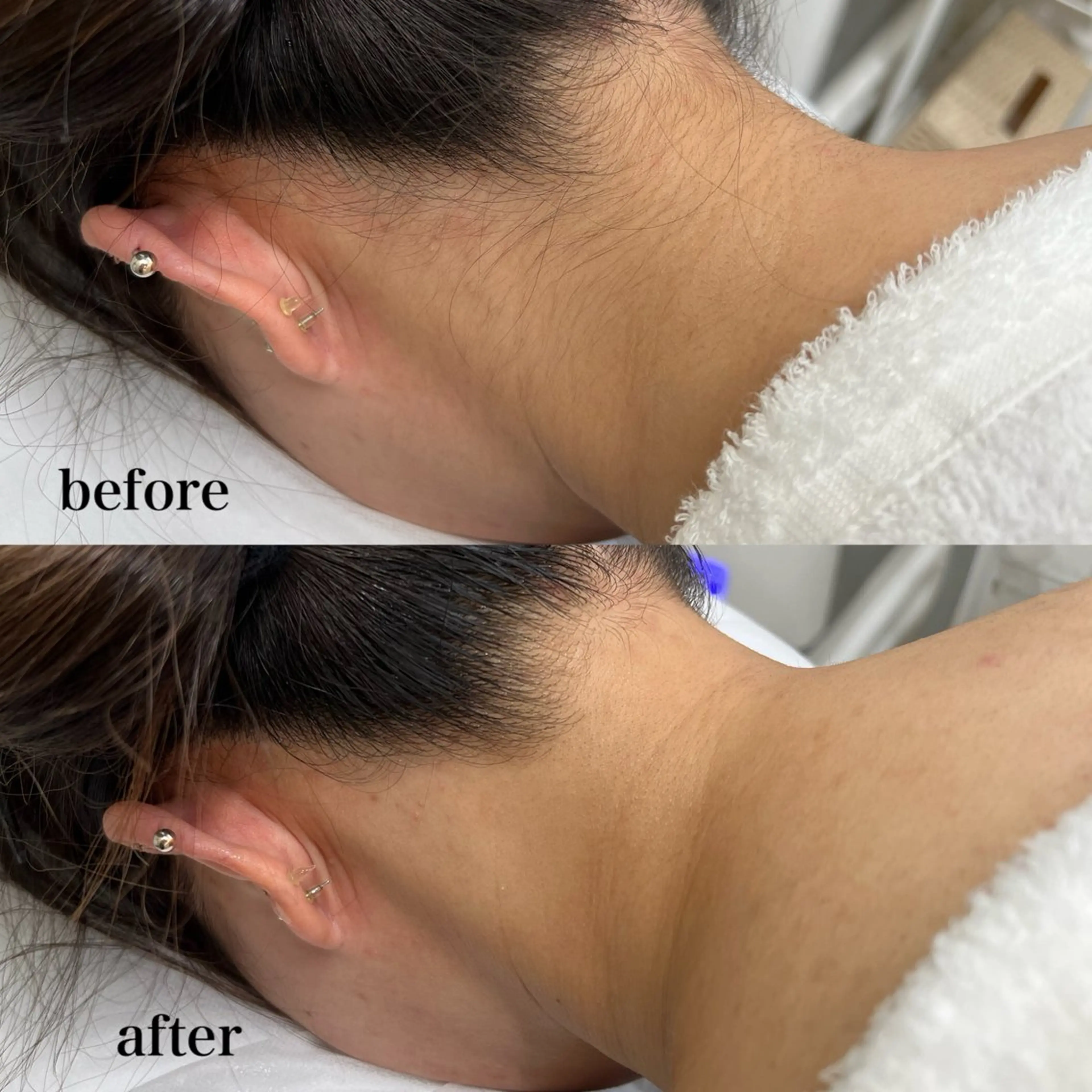 メンズ 脱毛 瀬戸 梨子のエステ・リラクイメージ