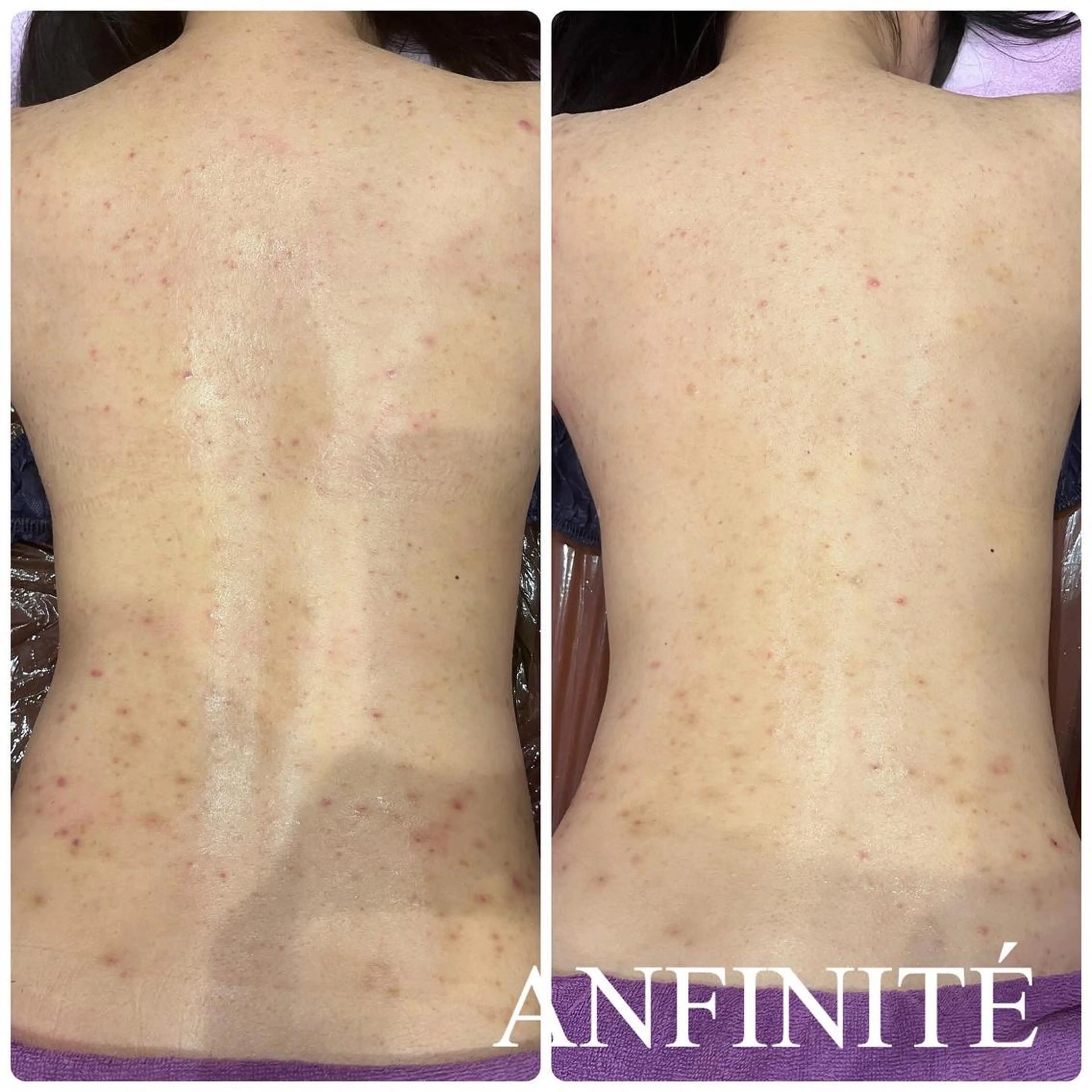 ANFINITÉ所属・ANFINITÉ アンフィニテのエステ・リラクイメージ