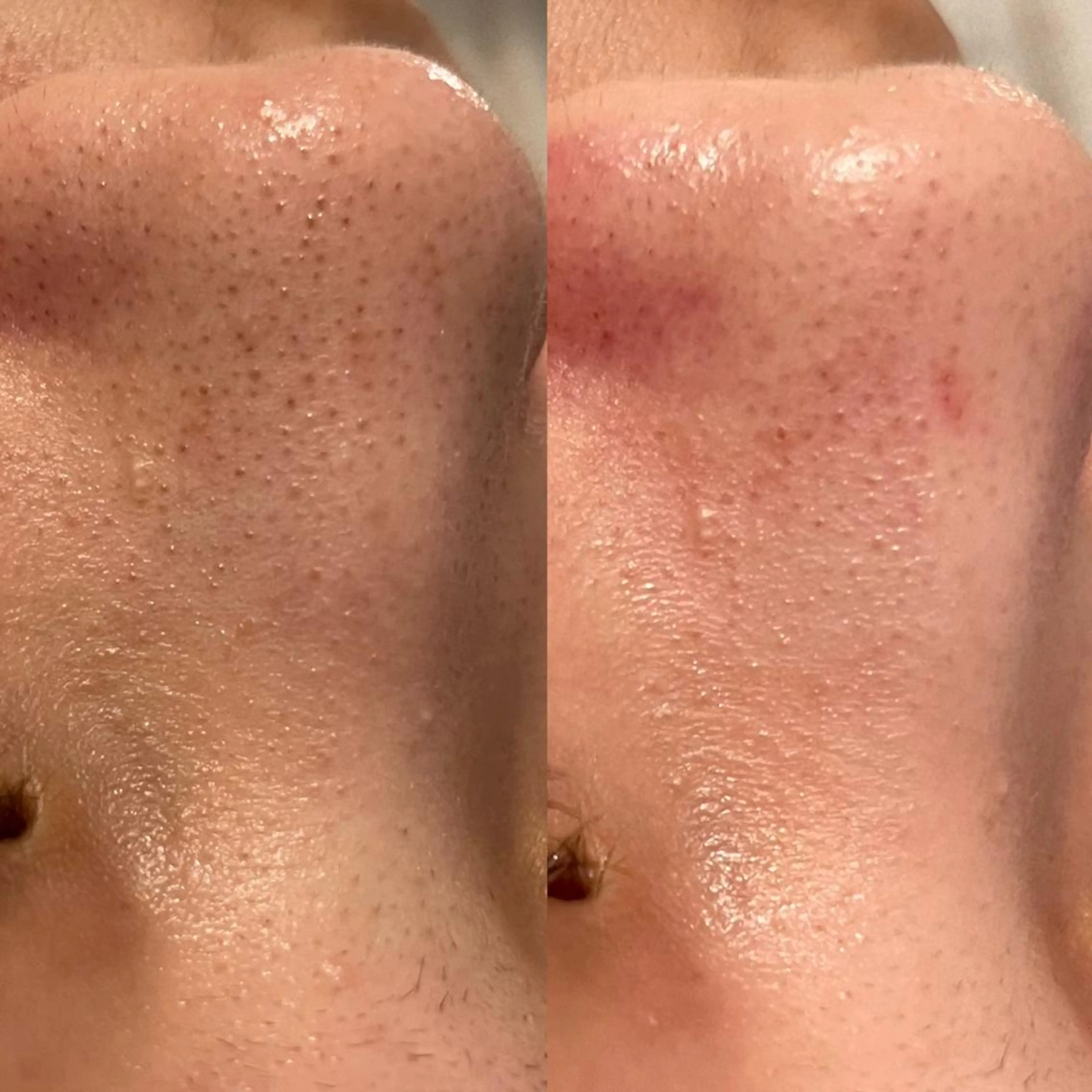 エステ ✨美肌水光✨ アトリエリュバンのエステ・リラクイメージ