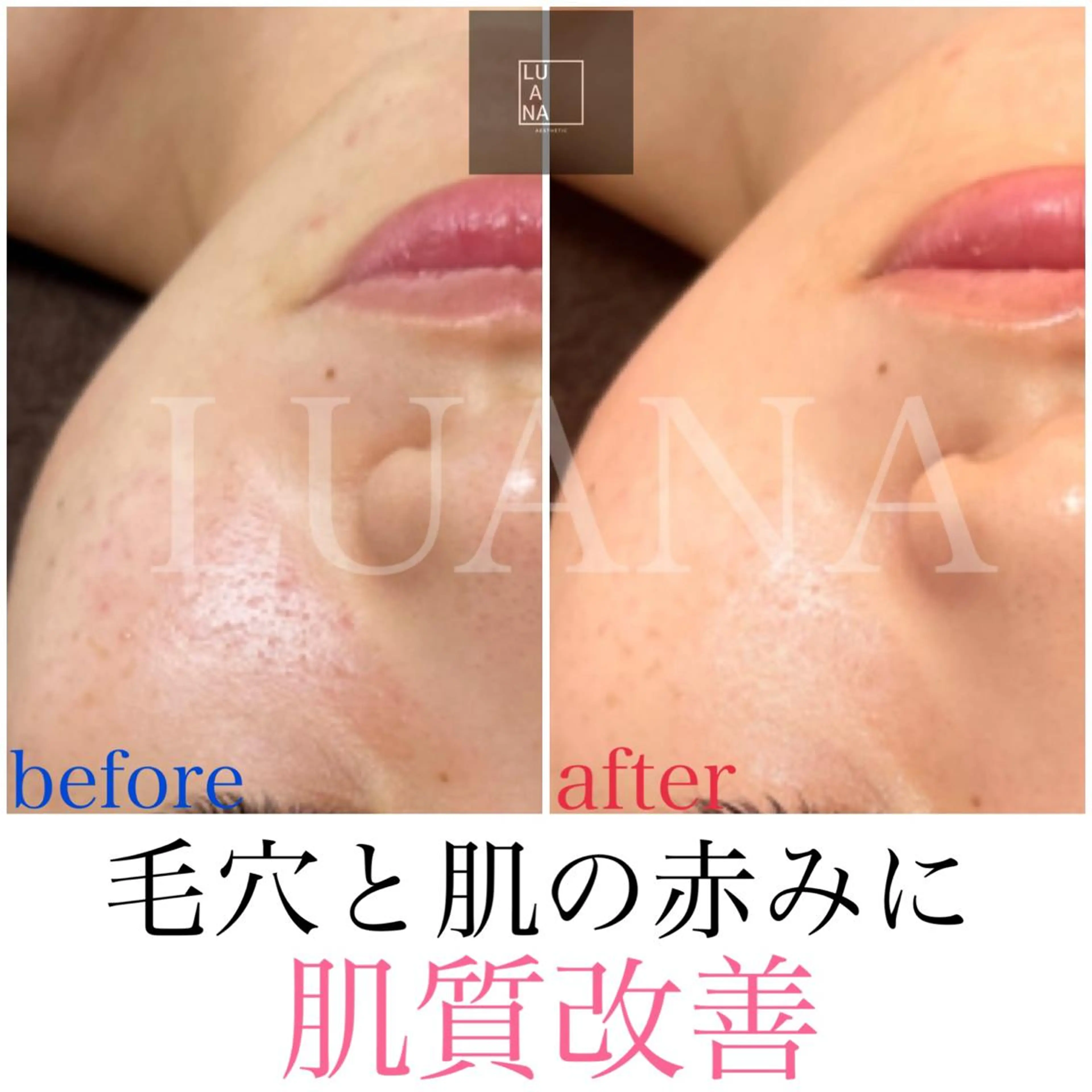 LUANA TAKAGIの眉毛・アイブロウイメージ