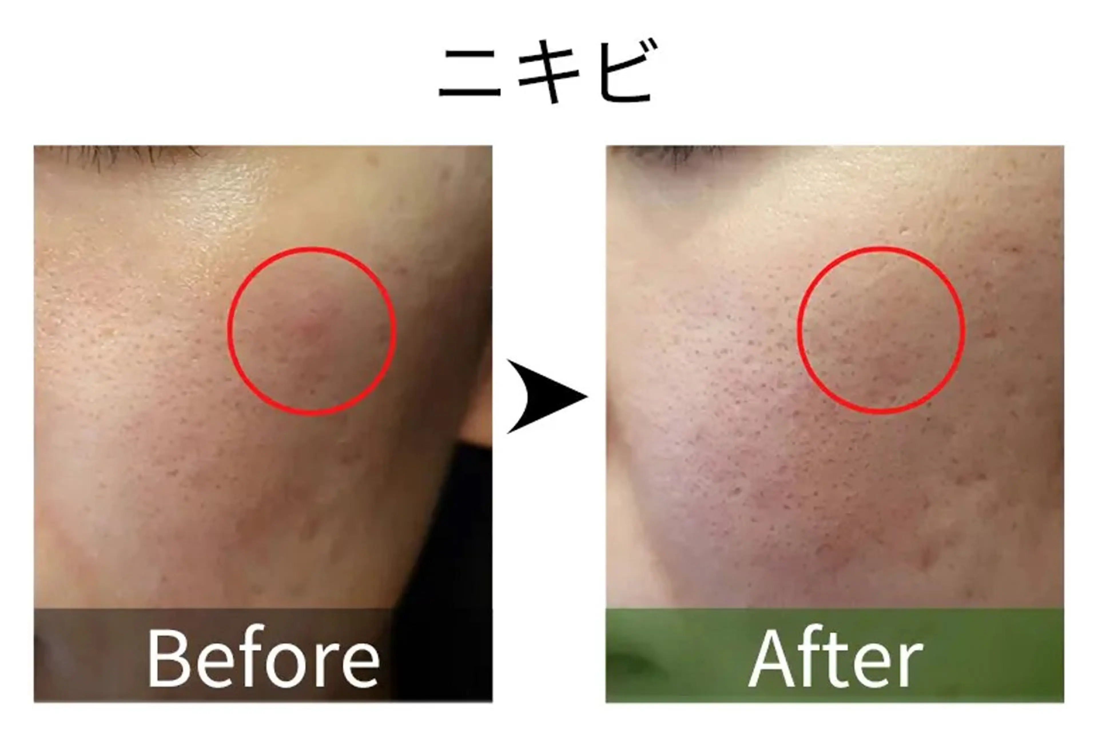 ハーブピーリング専門 muro.のエステ・リラクイメージ