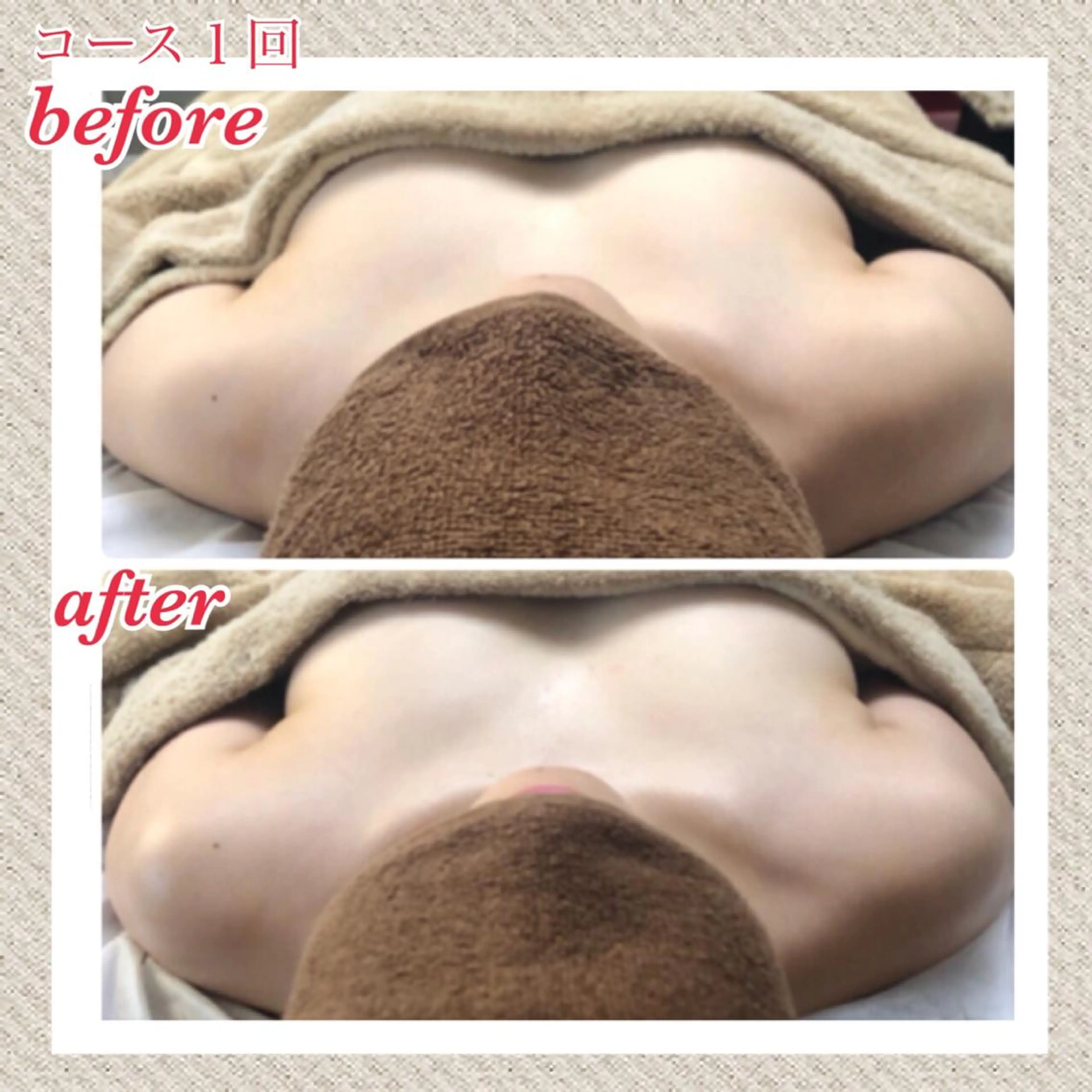 エステ リラク 美ola ビオラのエステ・リラクイメージ