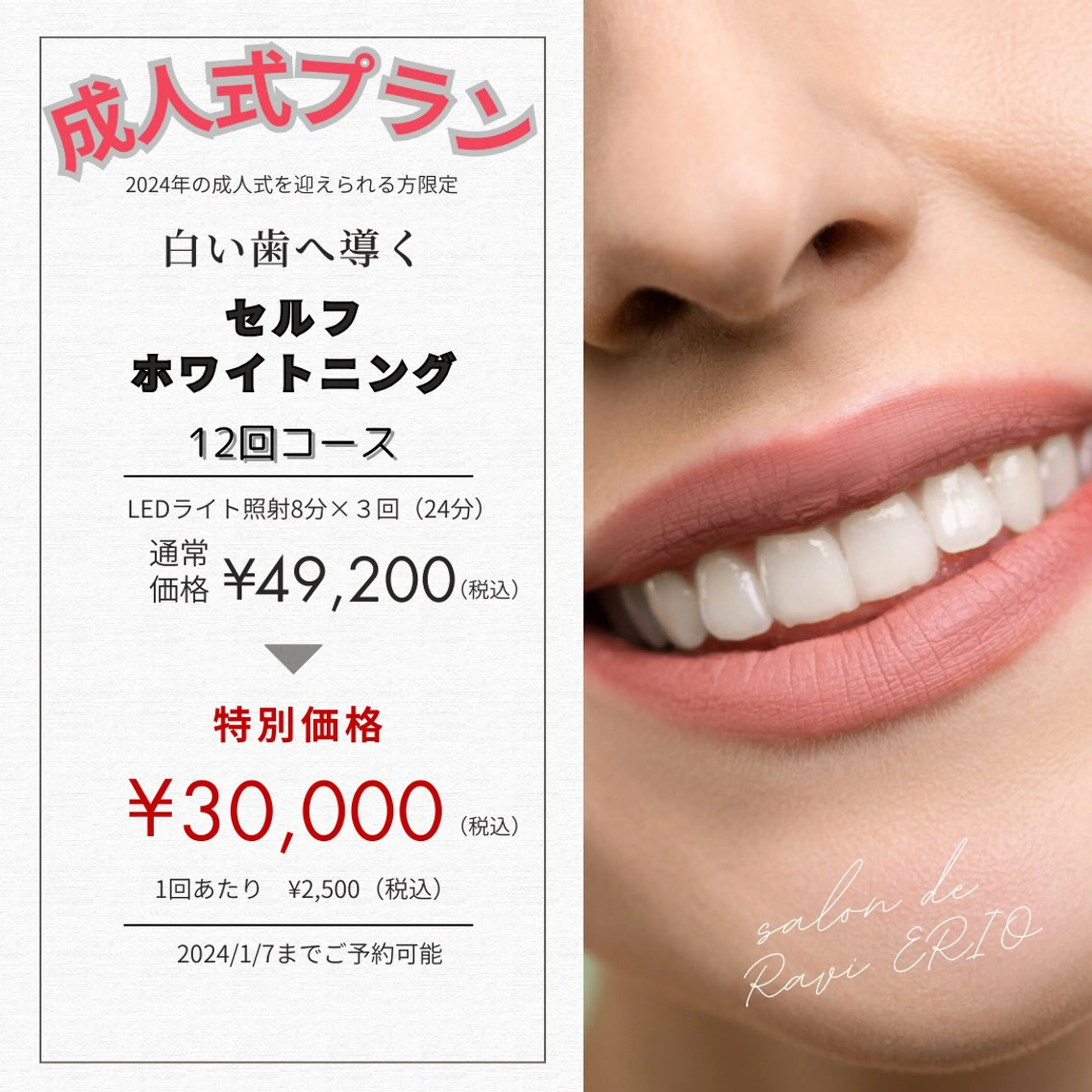 サロン ド ラヴィ エリオのその他イメージ