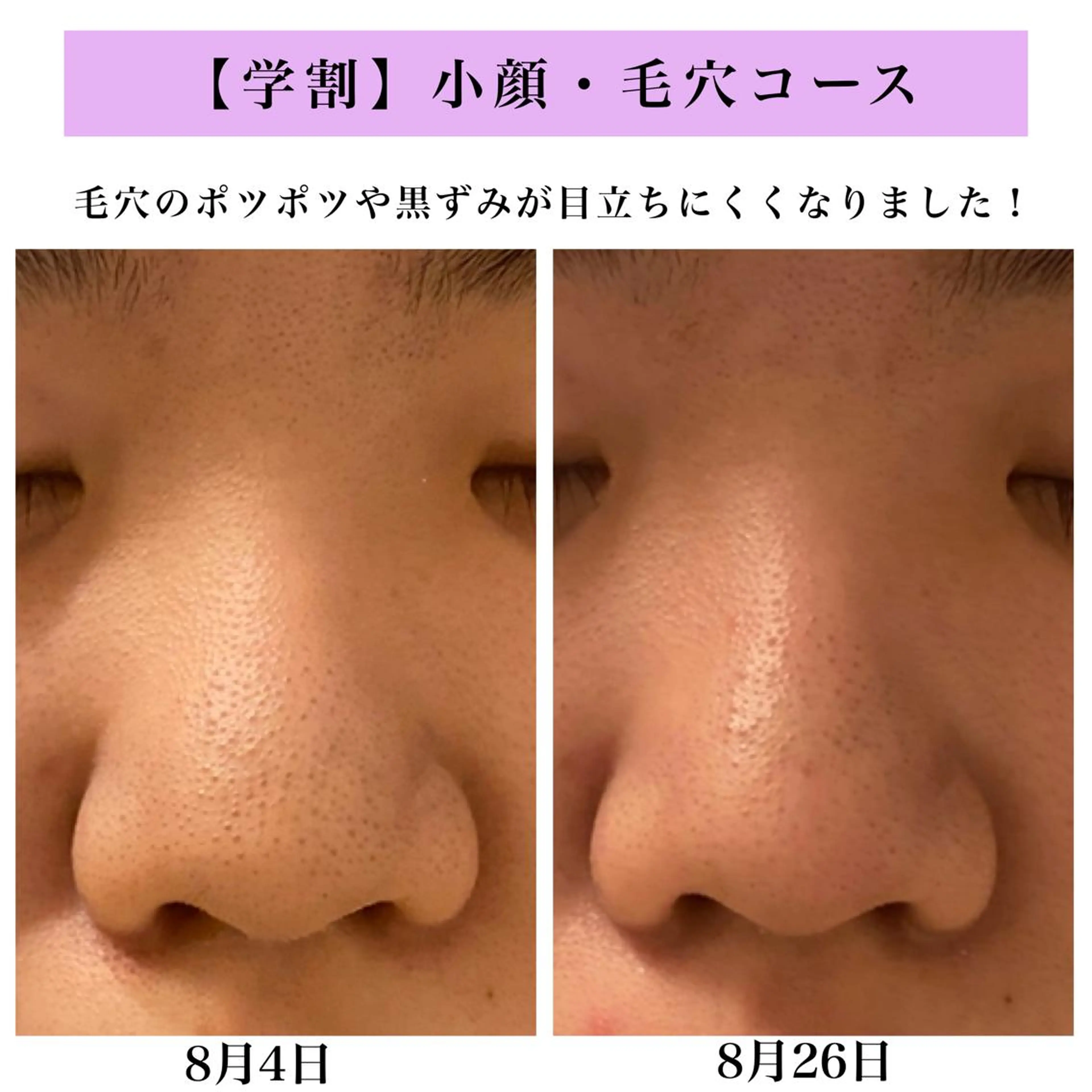 Bellesthe （ベルエステ）のエステ・リラクイメージ