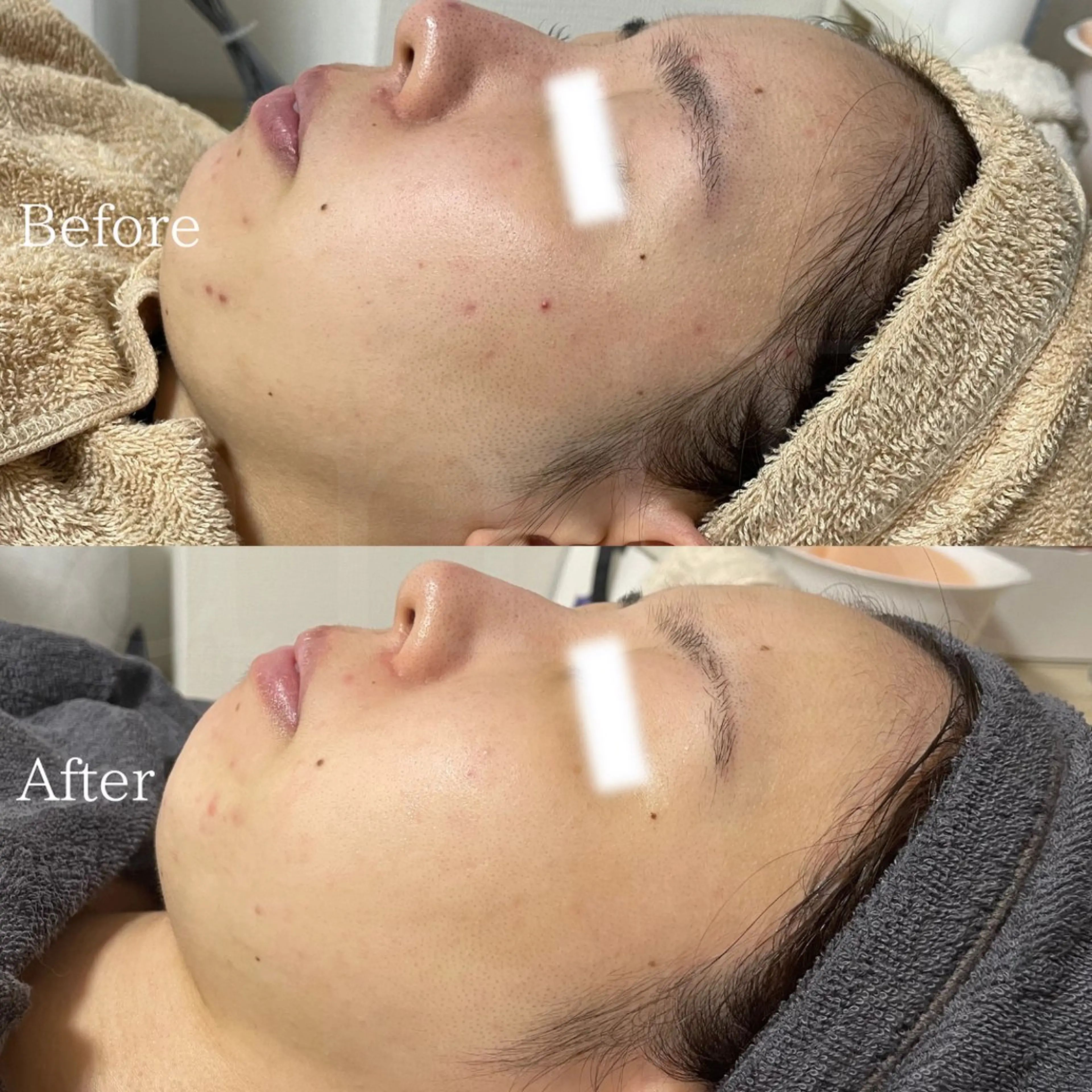 エステ 北浜/毛穴洗浄ツヤ肌 サロンaniRのエステ・リラクイメージ