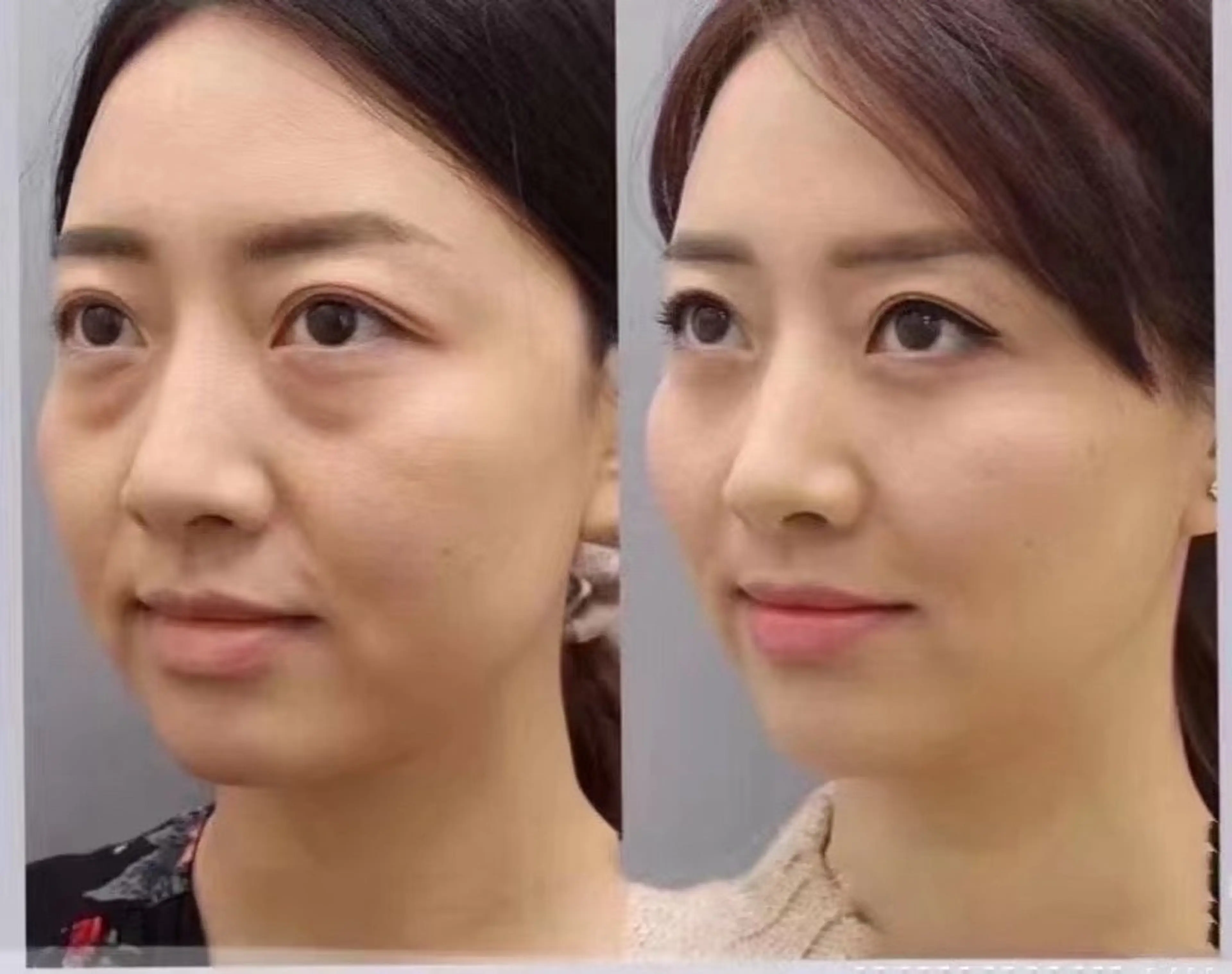 マツエク・マツパ エステ aliaハイフ&水光ジェットサロン所属・aliaハーブ水光店 エステティシャン募集のエステ・リラクイメージ