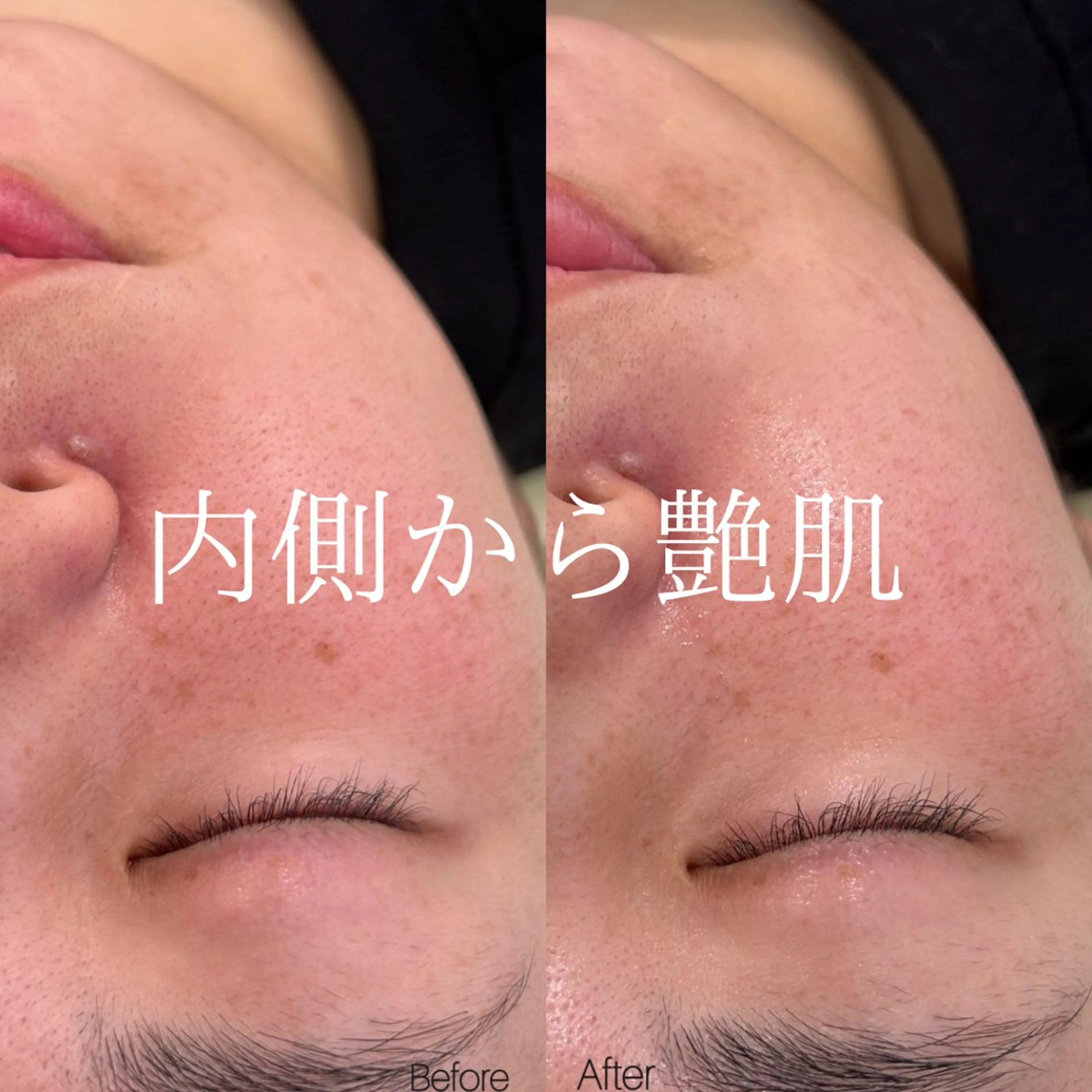 〈etre〉トータルビューティーサロン所属・etre - 韓国肌管理 -のエステ・リラクイメージ