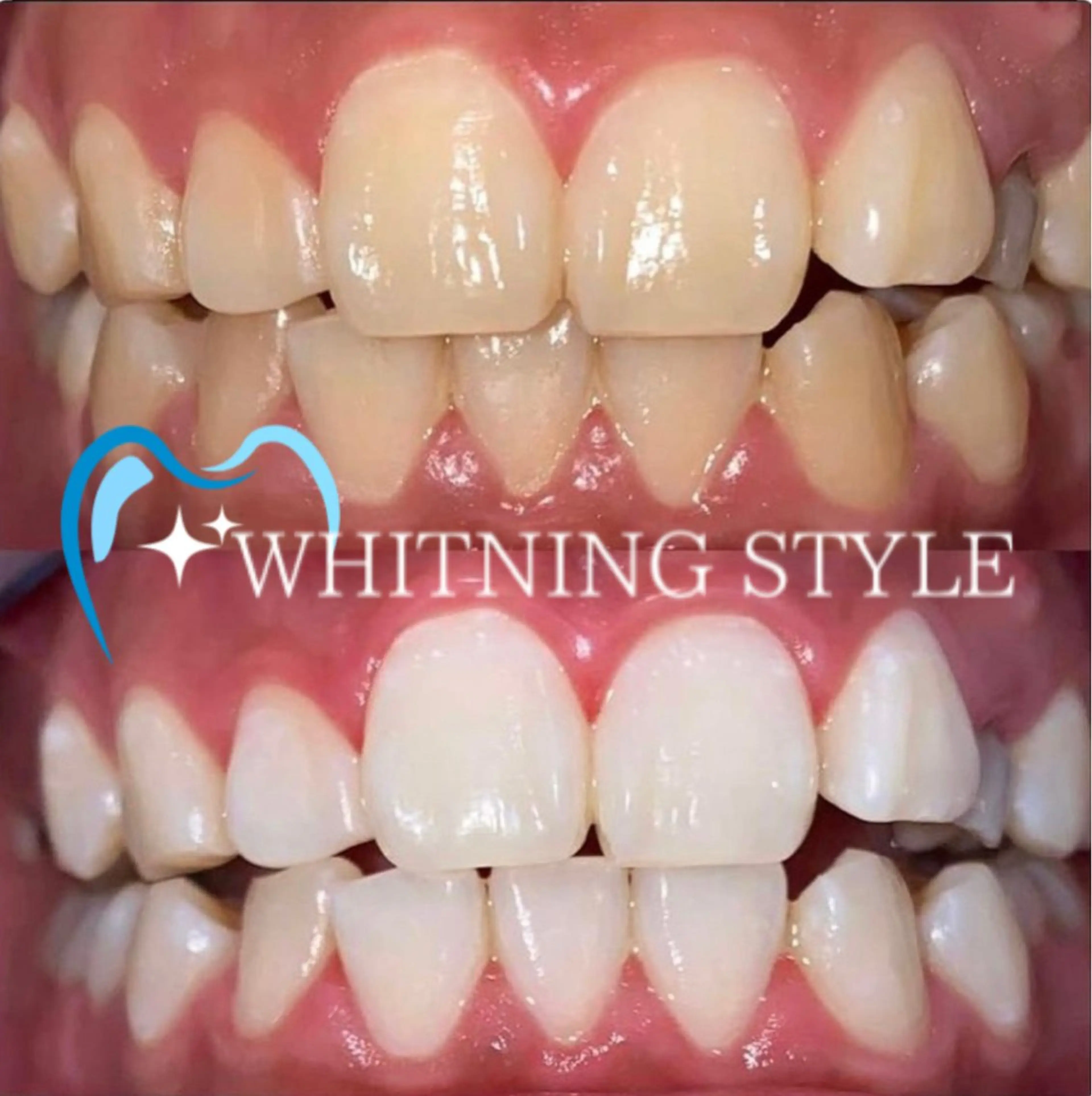 カラー その他 プラチナムビューティー柏所属・【歯科提携】柏ホワイ トニングスタイルのその他イメージ