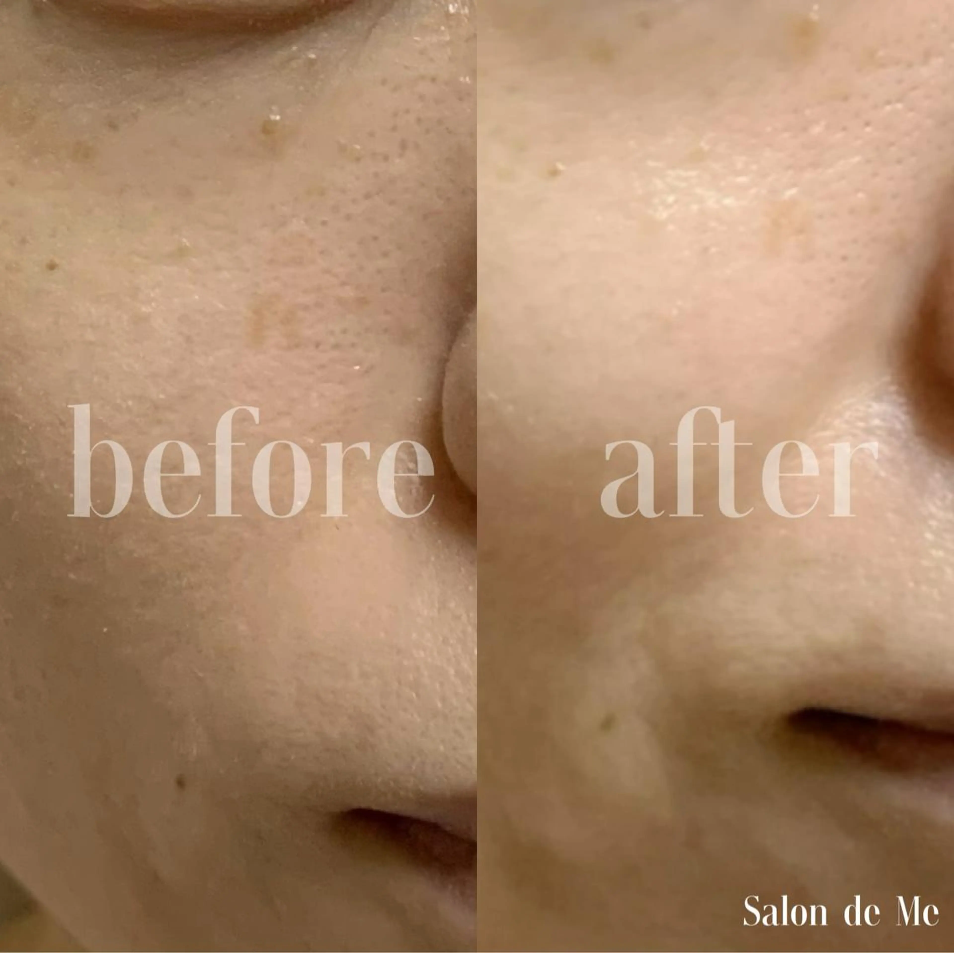 Salon de Me所属・💫Salon de Me💫予約停止中のエステ・リラクイメージ