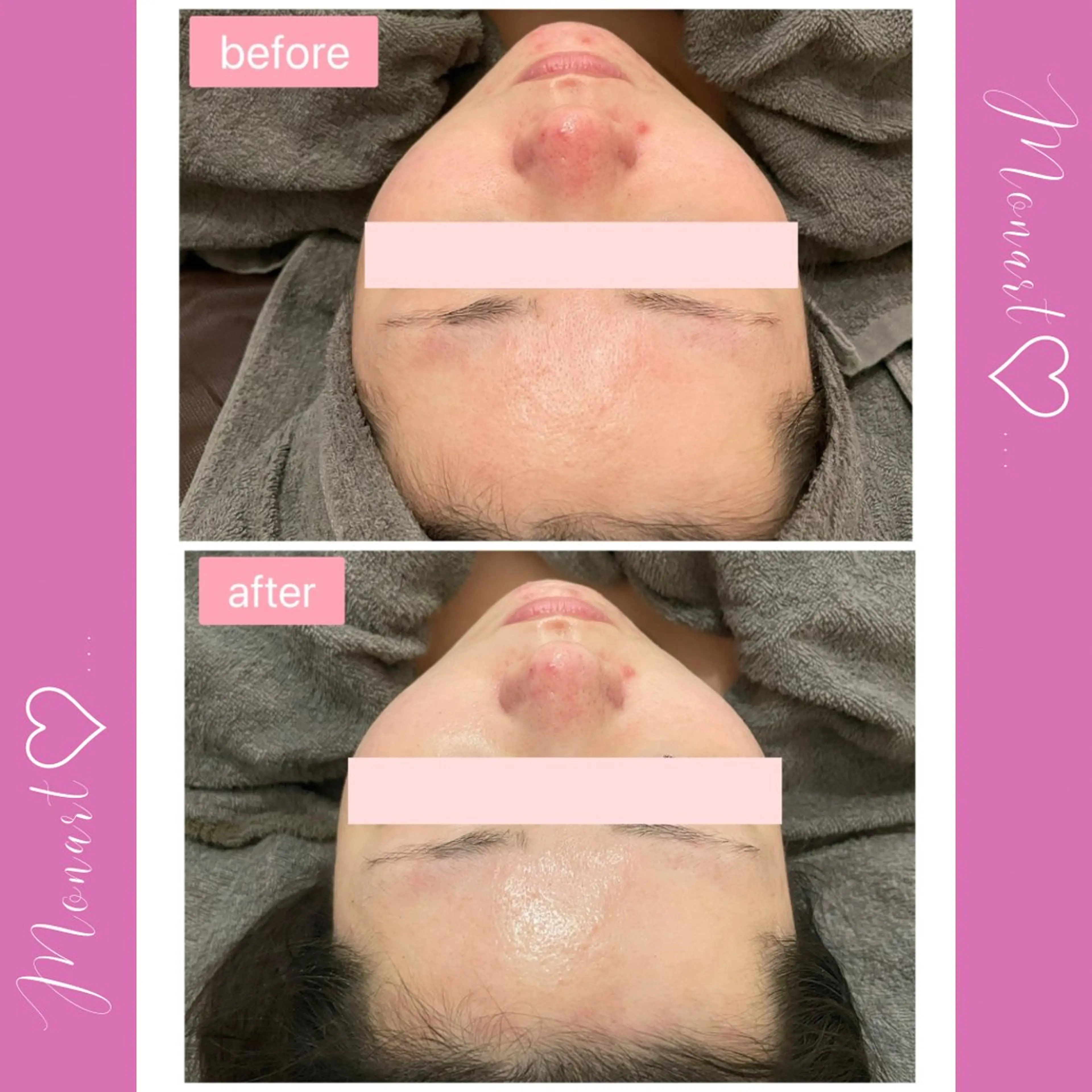 Monart -deux-のエステ・リラクイメージ