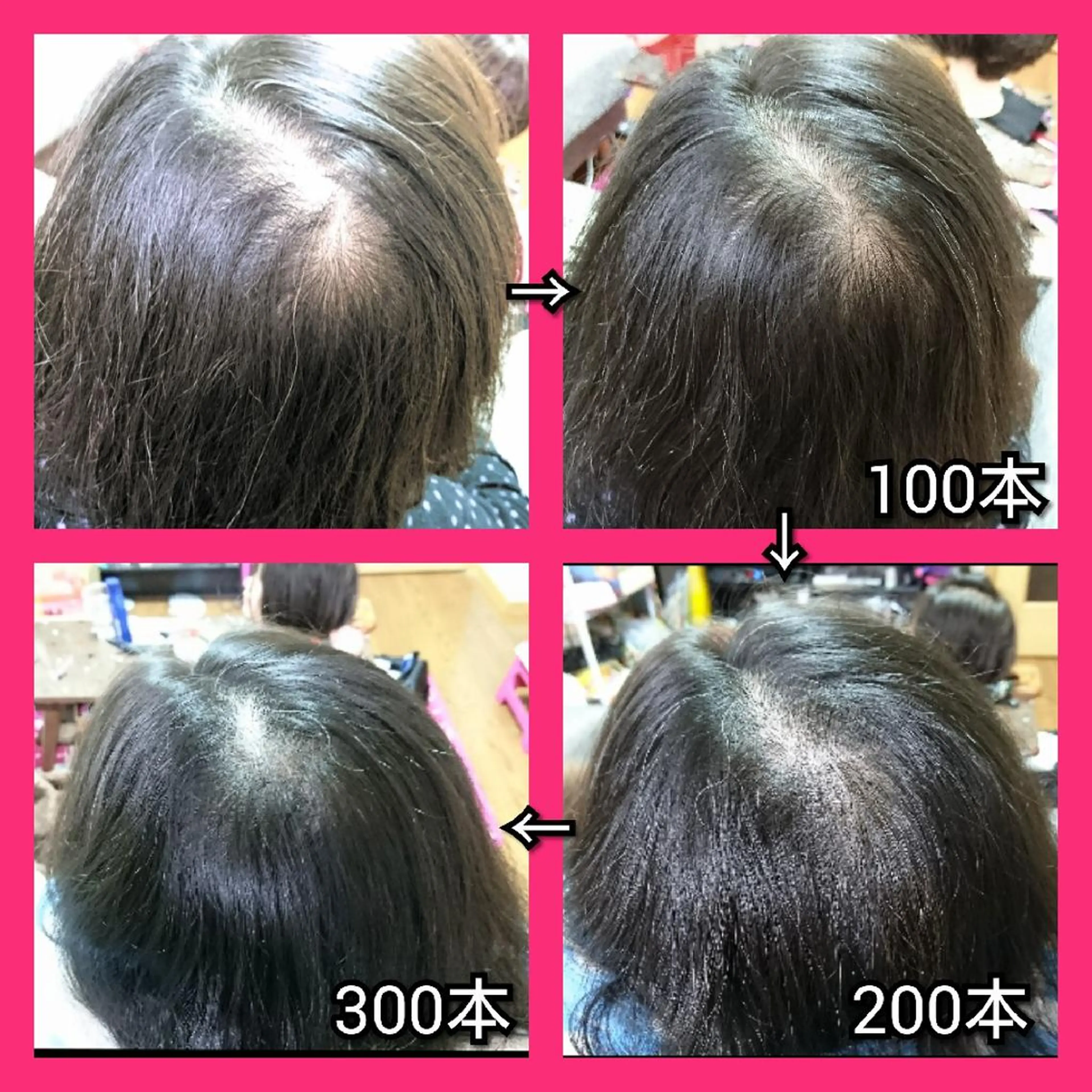 ヘアアレンジ ミディアム nail yukkoのネイルデザイン