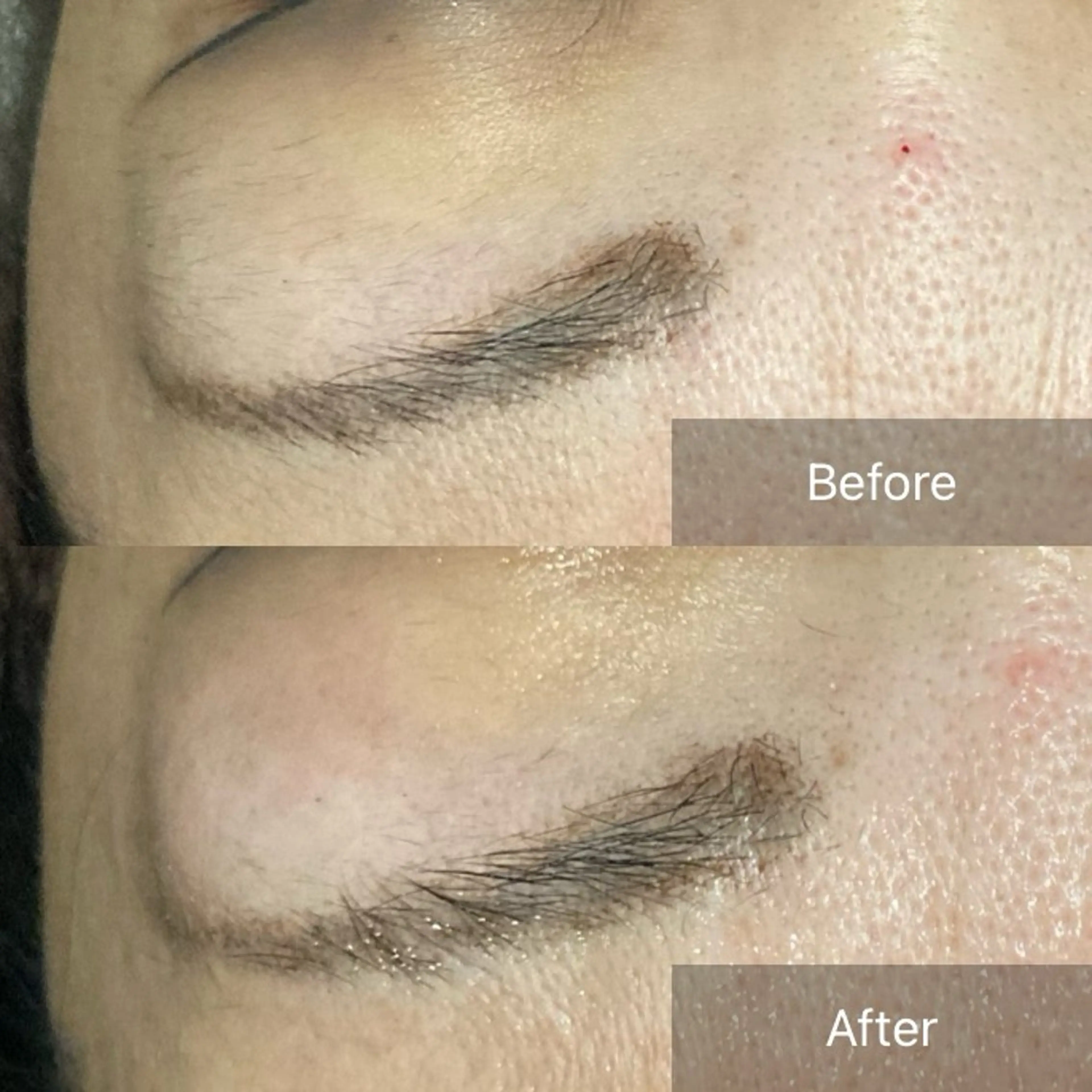 脱毛 産毛専門店 Bittoのエステ・リラクイメージ