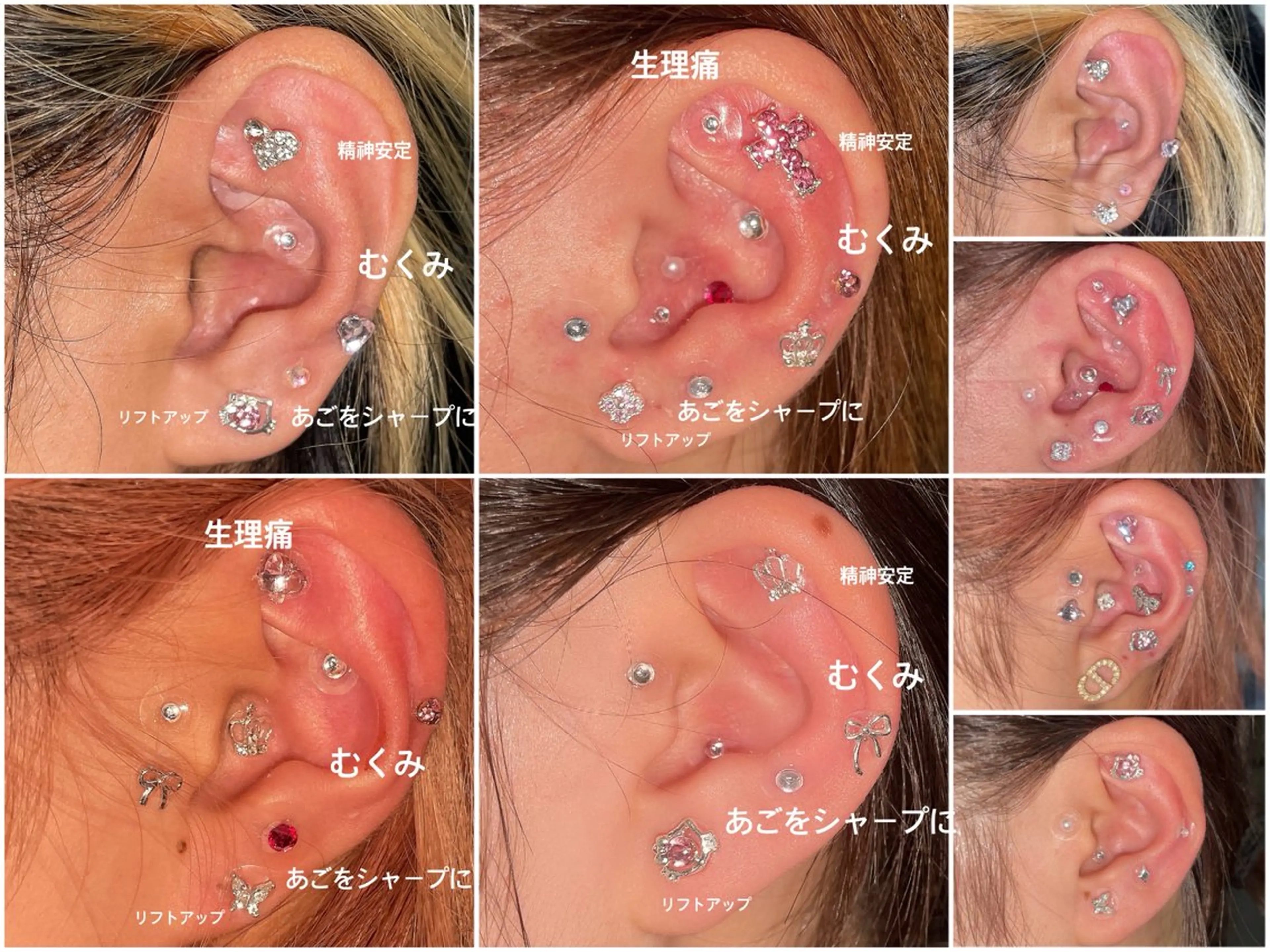 耳ツボジュエリーの写真