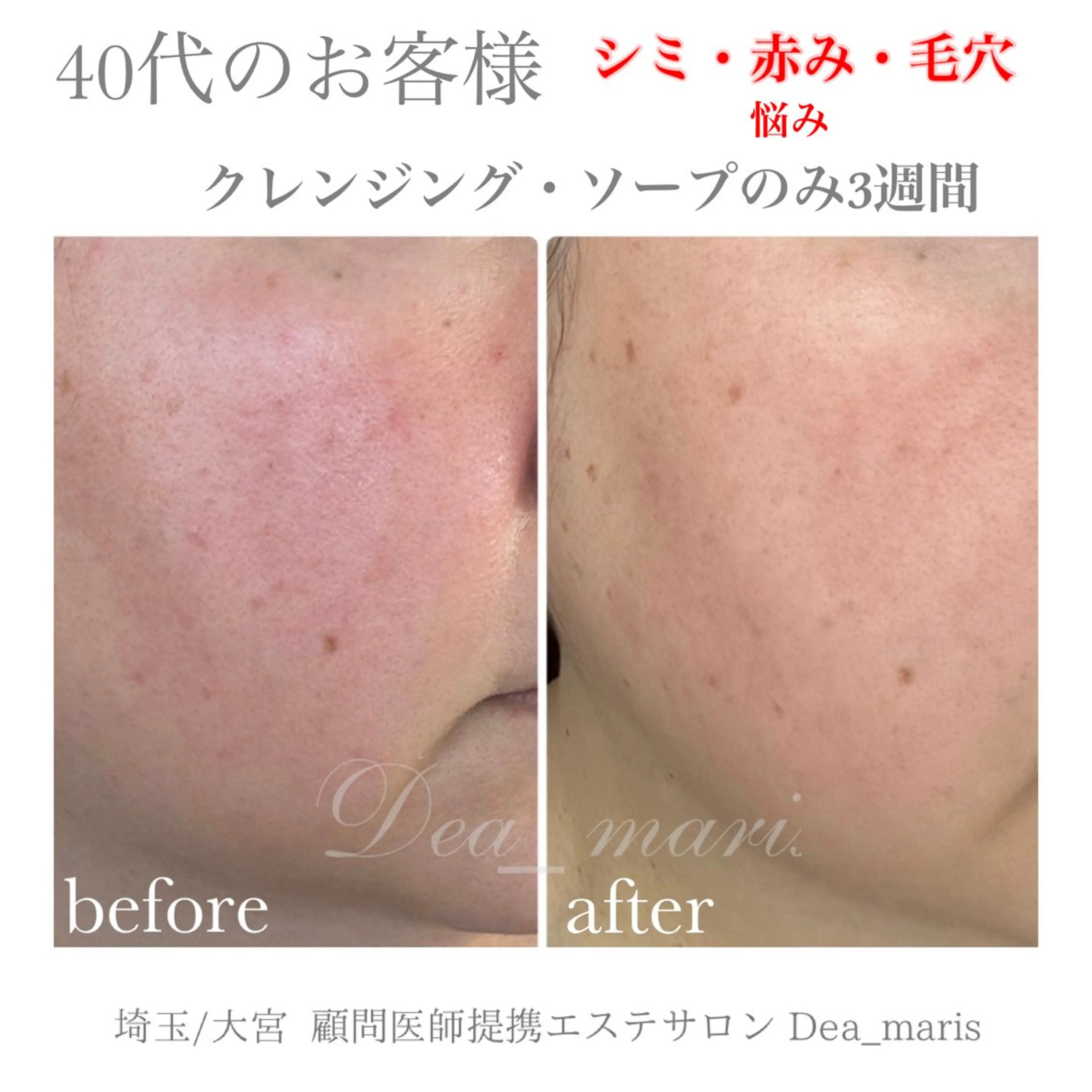 private salon  Dea_maris シュガーリング＆パーソナルボディケア所属・シミ改善・韓国肌管理 ボディメイク痩身のその他イメージ