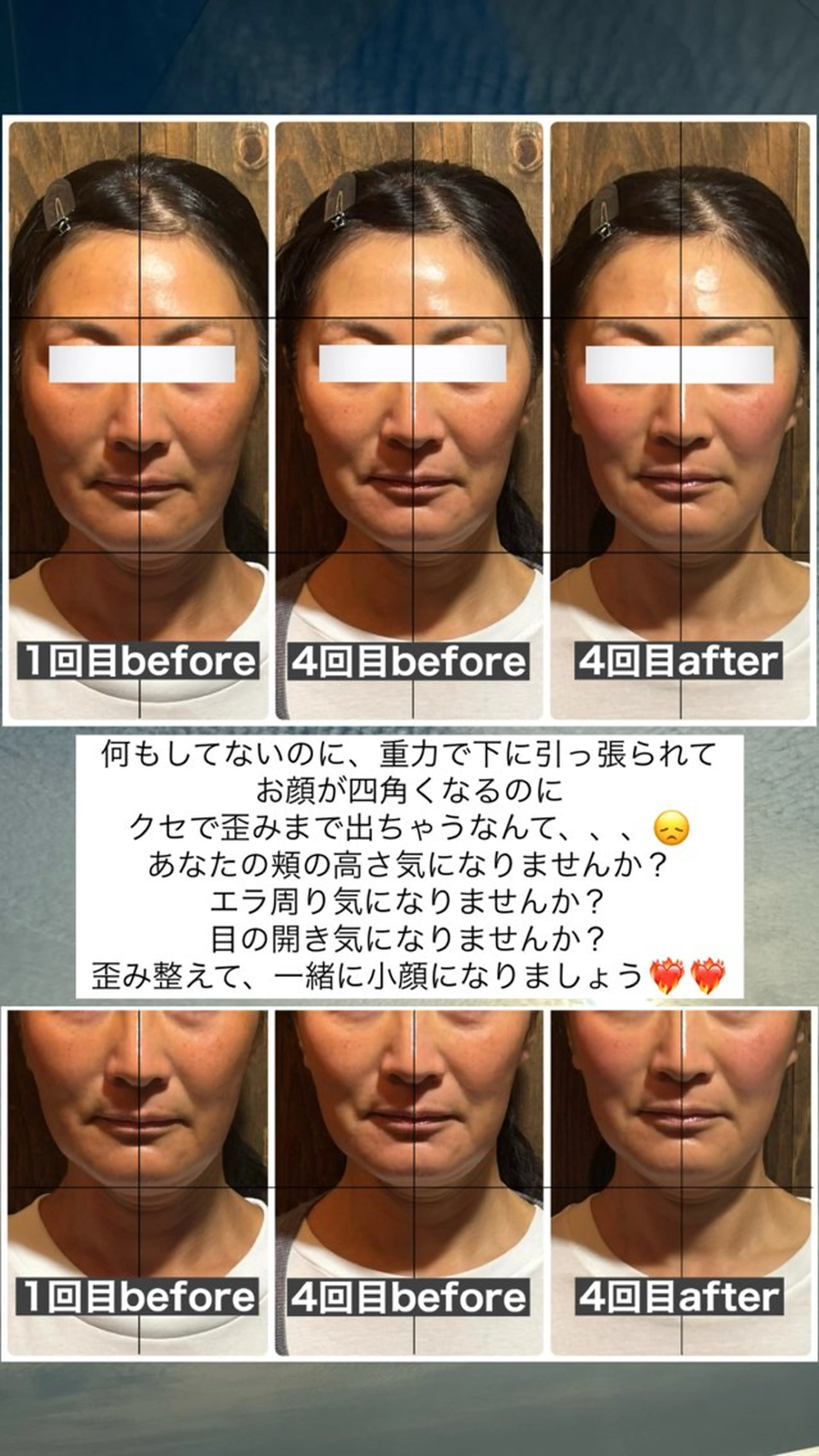 エステ リラク 💎後悔させない小顔 矯正💎イトヤマ🌱のエステ・リラクイメージ