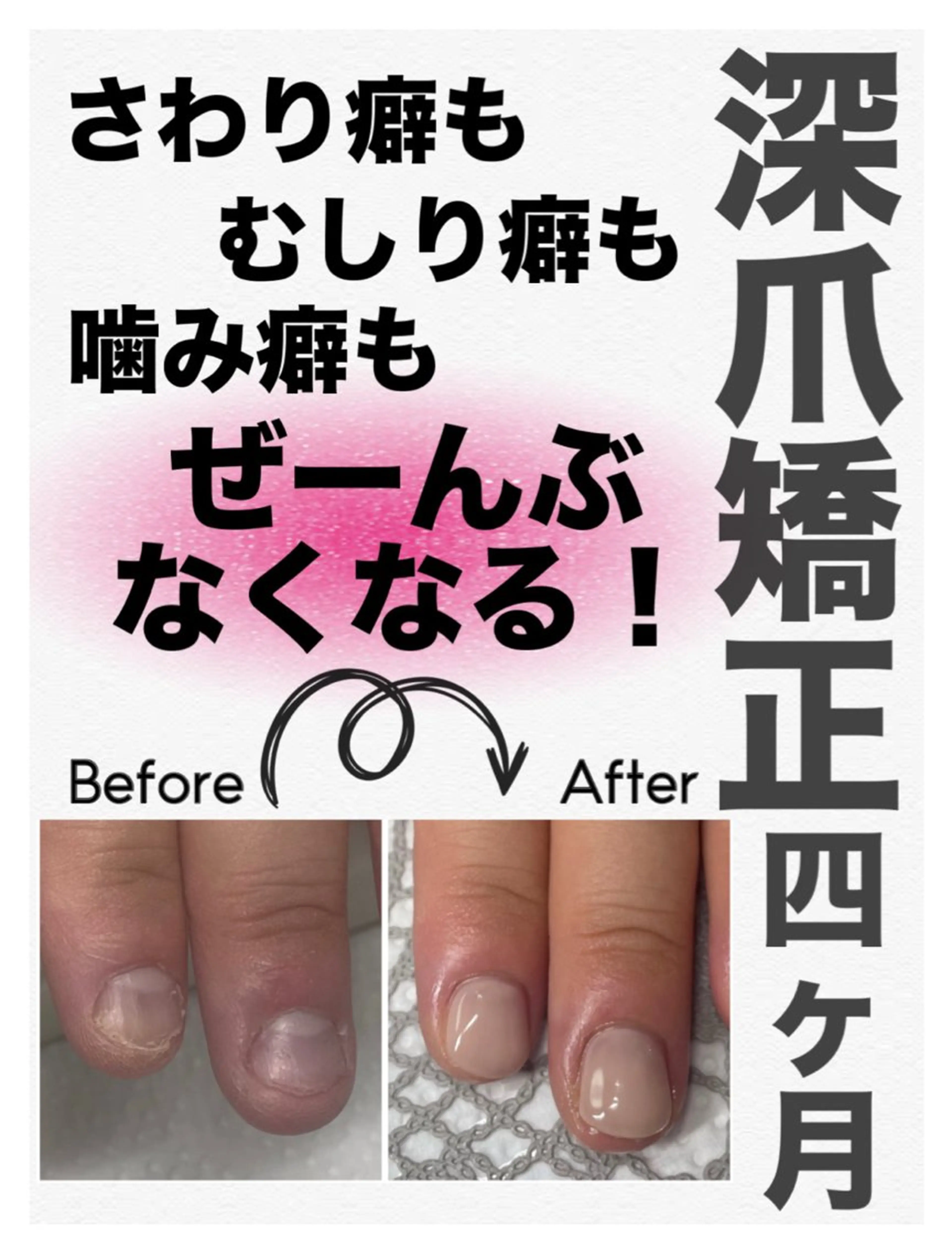 ネイル 長さ出し ジェルネイル 春ネイル ハンドネイル ハンドケア petillant所属・nail salon petillantのネイルデザイン