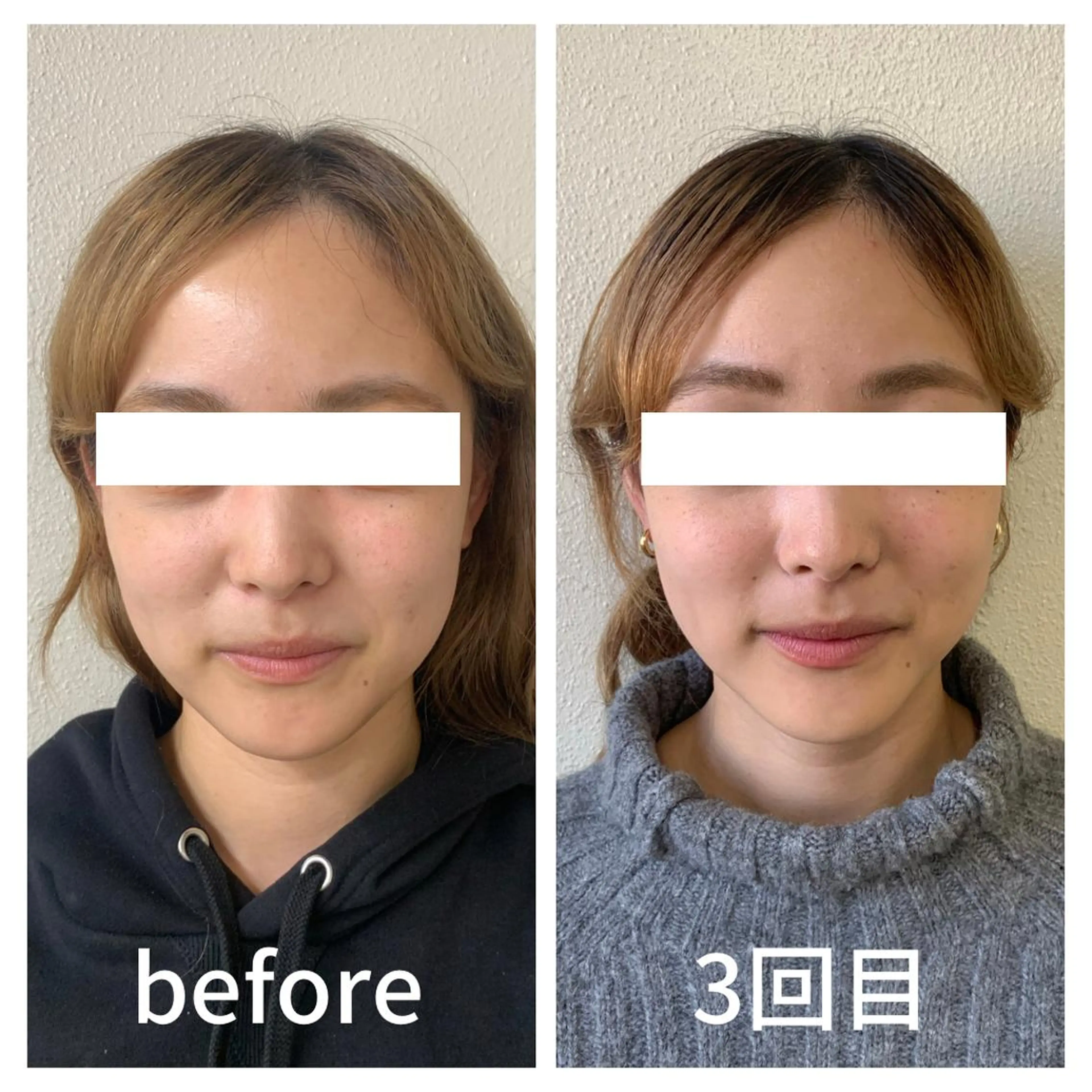 小顔サロン AMYONのエステ・リラクイメージ