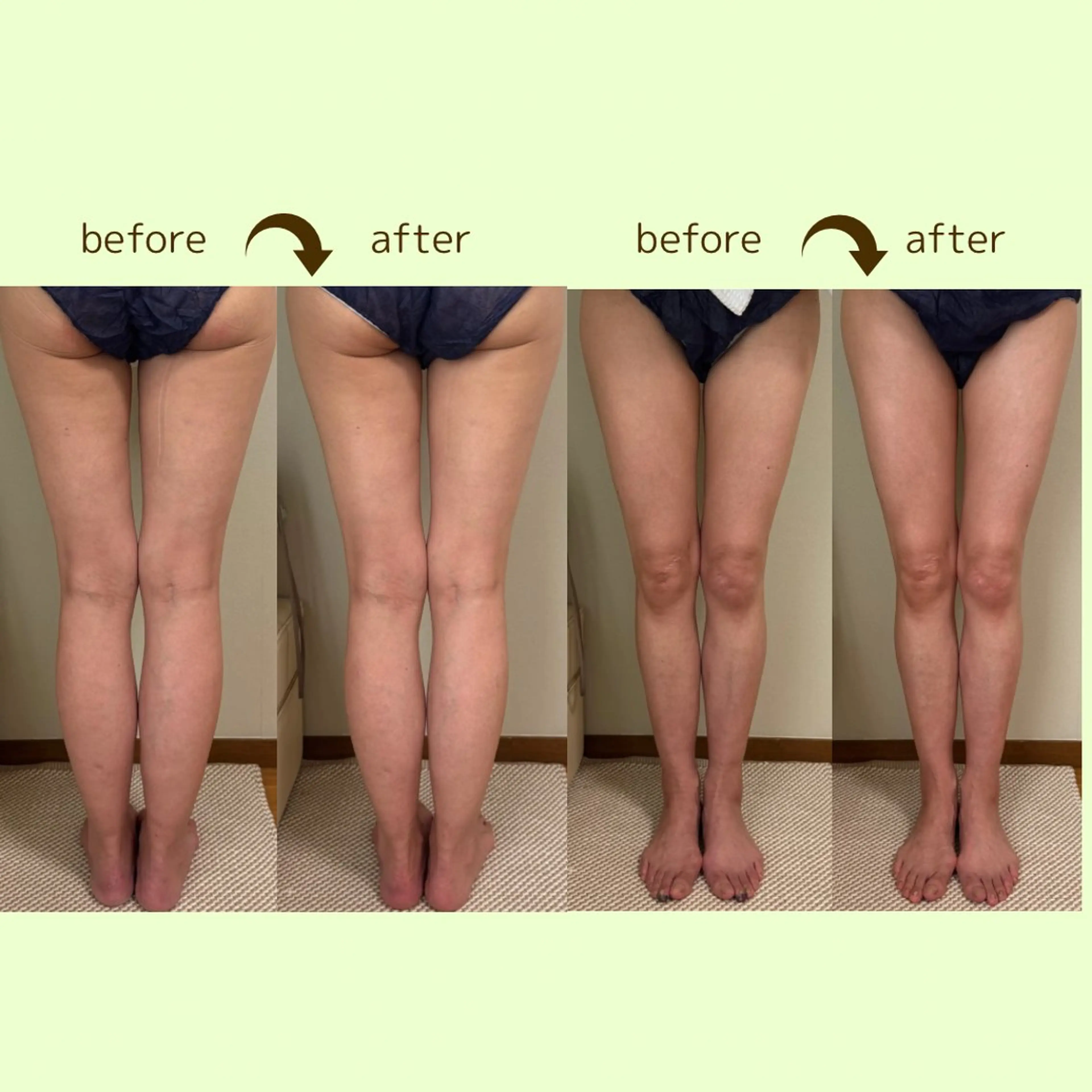 リラクゼーションスパ　ひのき所属・spaHINOKI 【女性専用】のエステ・リラクイメージ