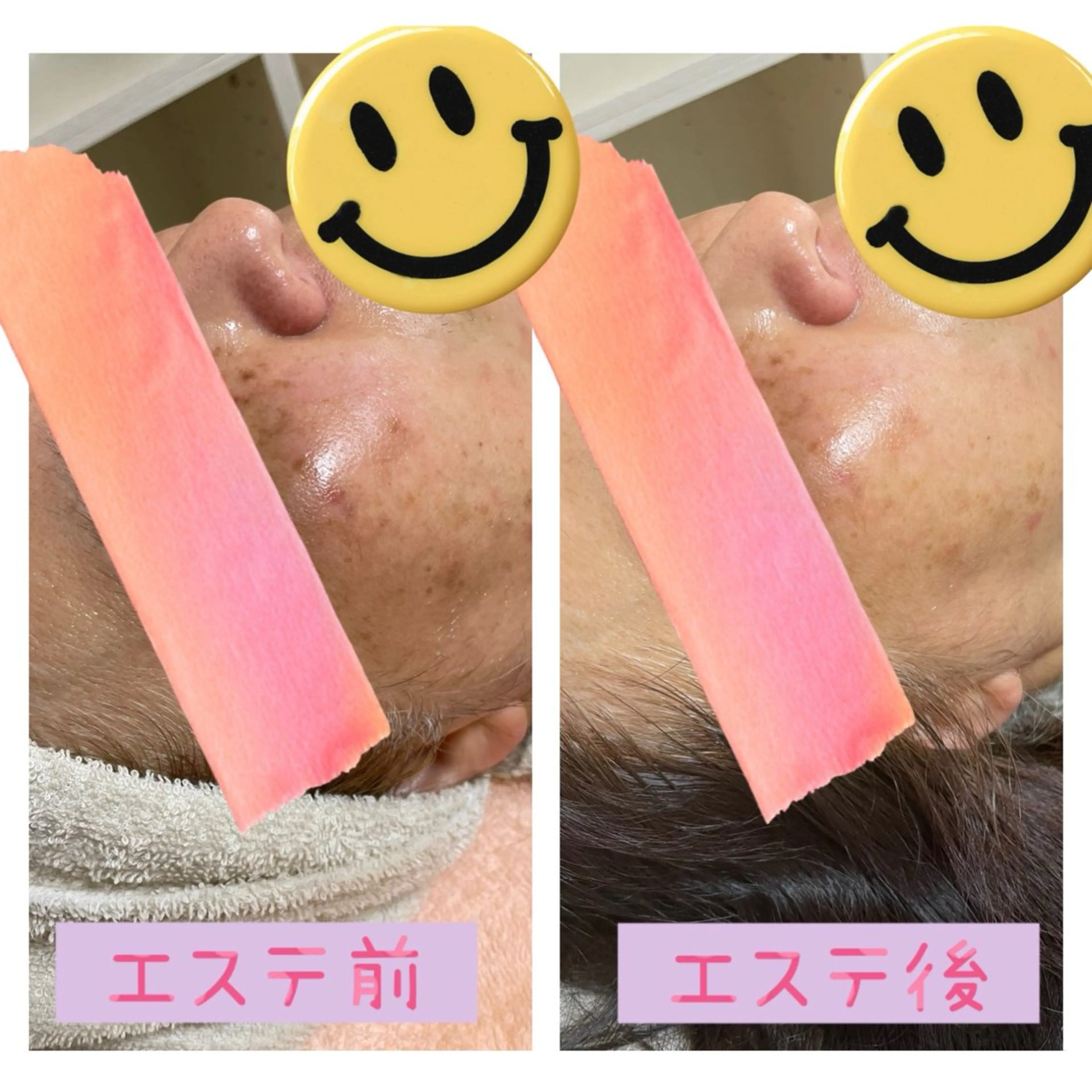 【初回限定】毛穴すっきり×リンパフェイシャル60分 ¥3,500の写真