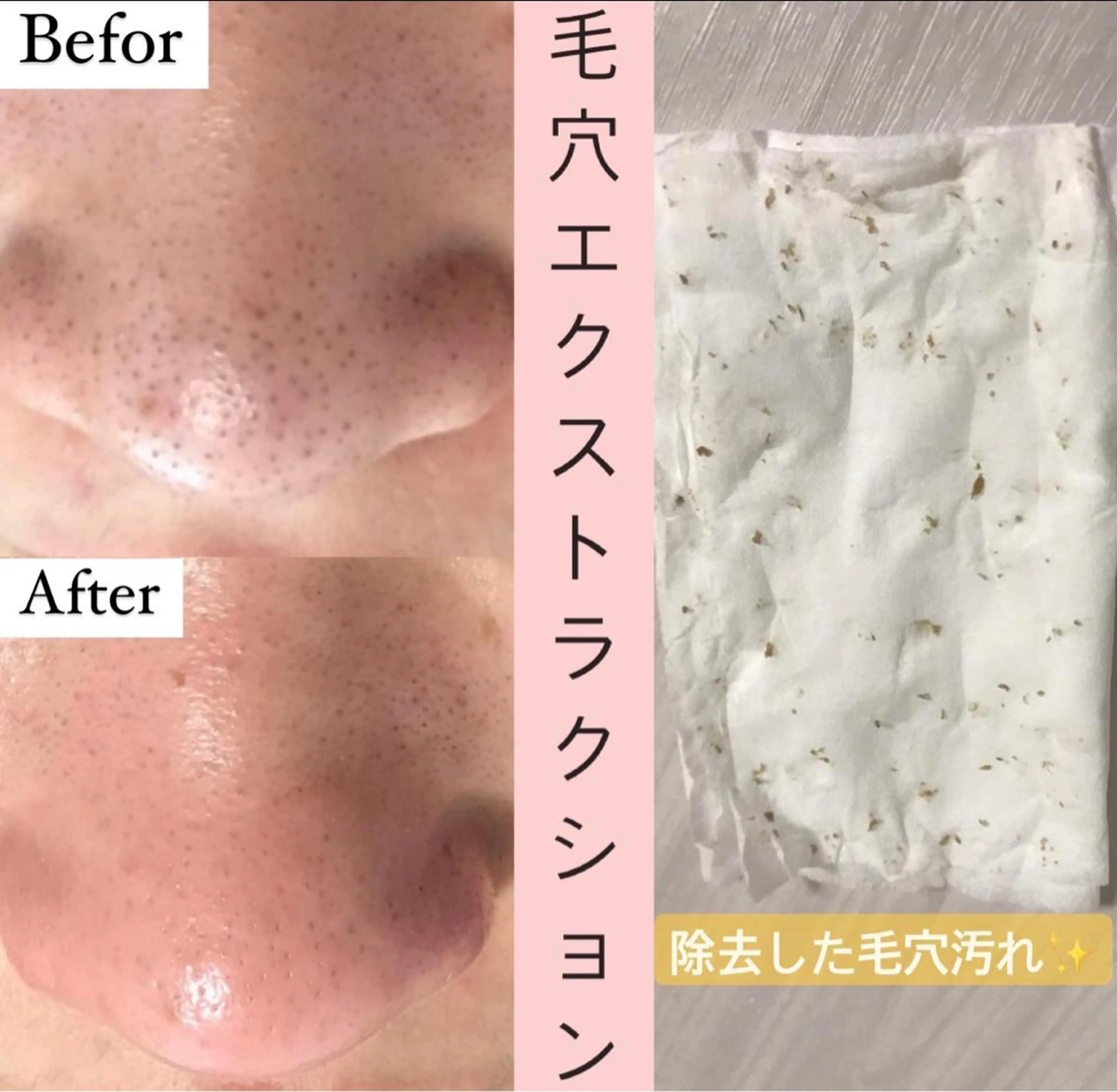 エステ リラク プライベートサロン emma【エマ】のその他イメージ