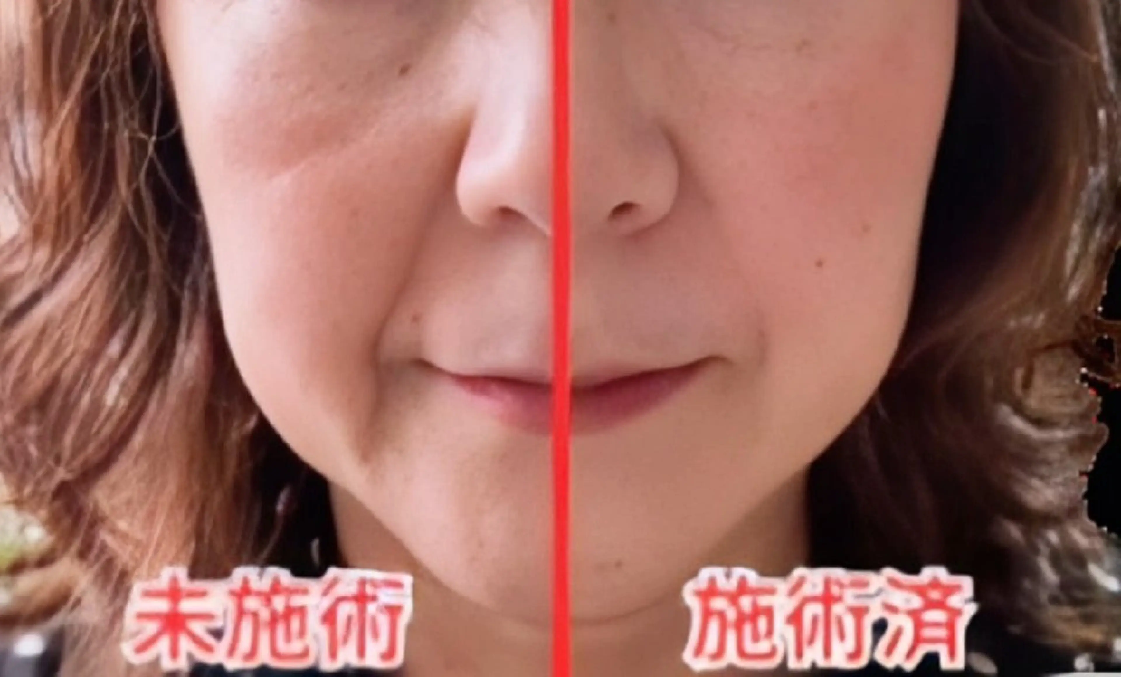 Hisui 種村のエステ・リラクイメージ