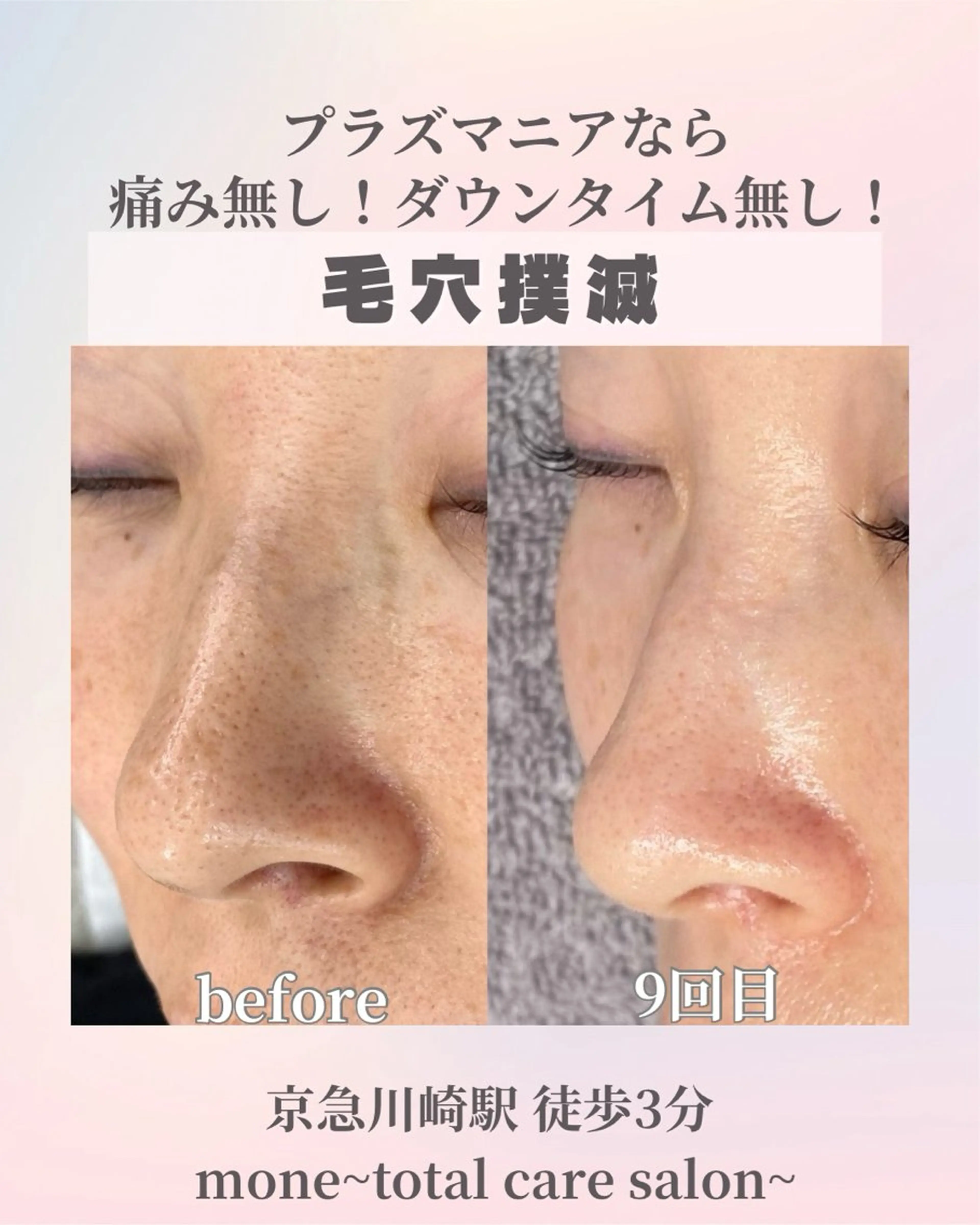 エステ mone~total care salon~所属・mone (モーネ)のマツエク・マツパデザイン