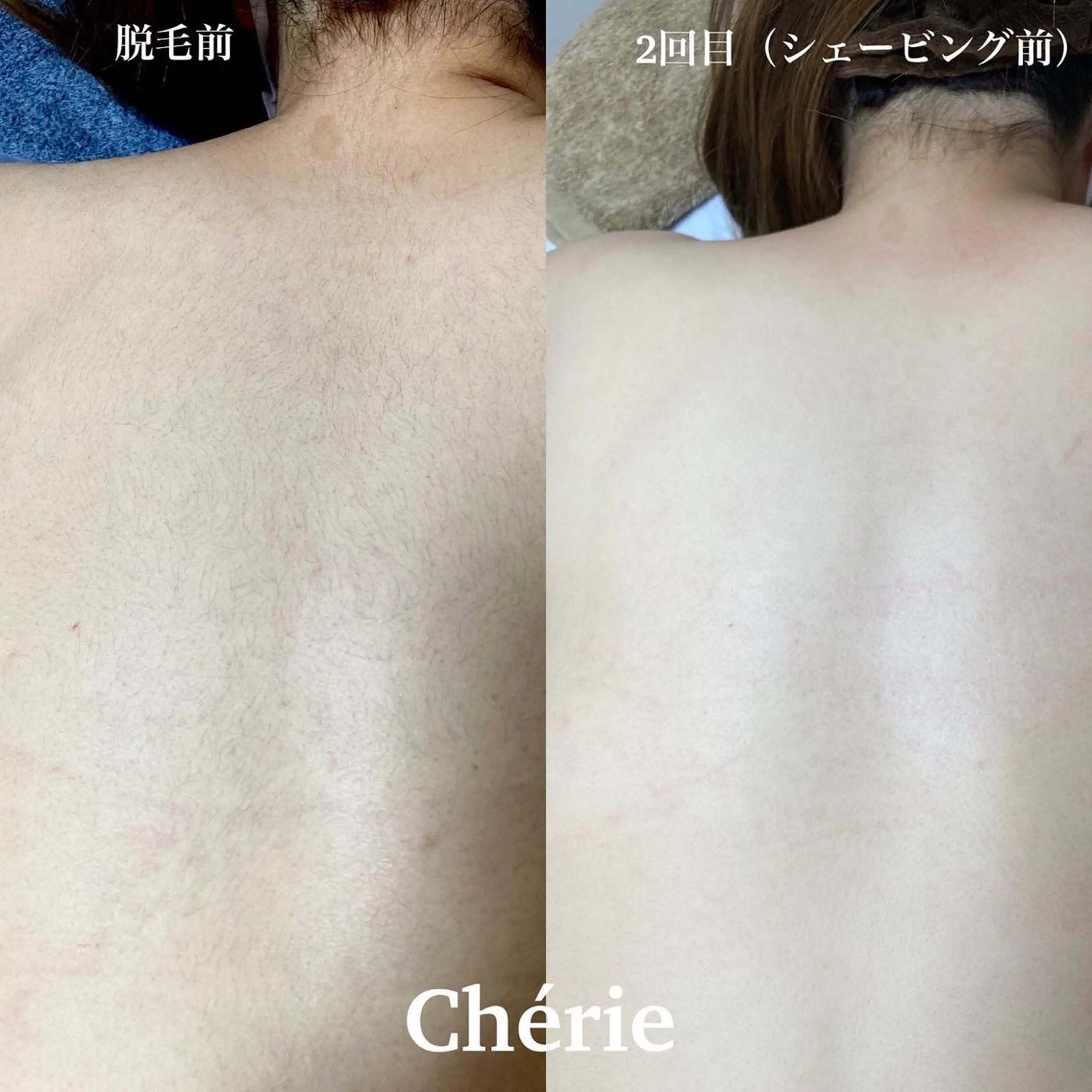 大津 香（シェリー）のエステ・リラクイメージ