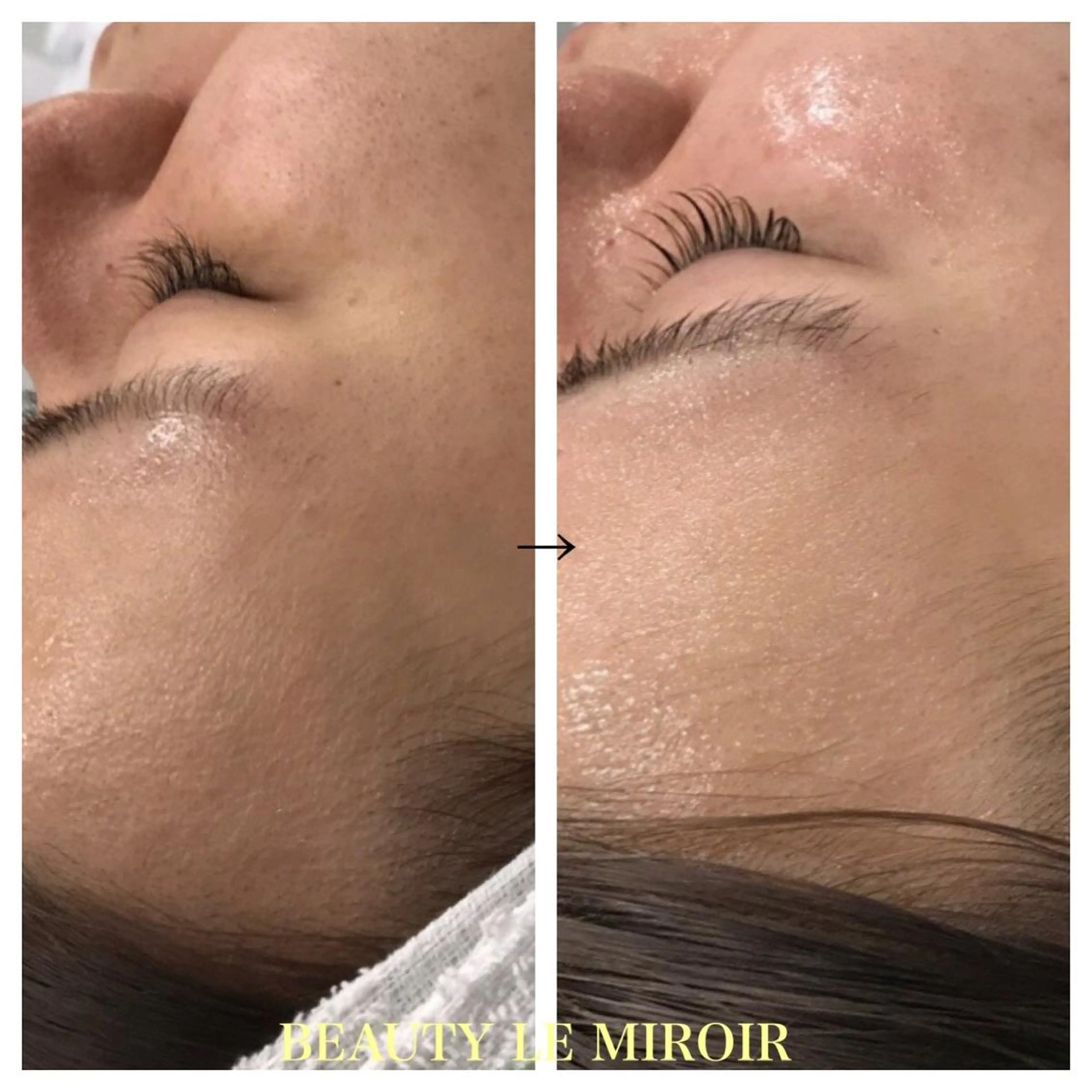 ビューティー ミロワールのエステ・リラクイメージ