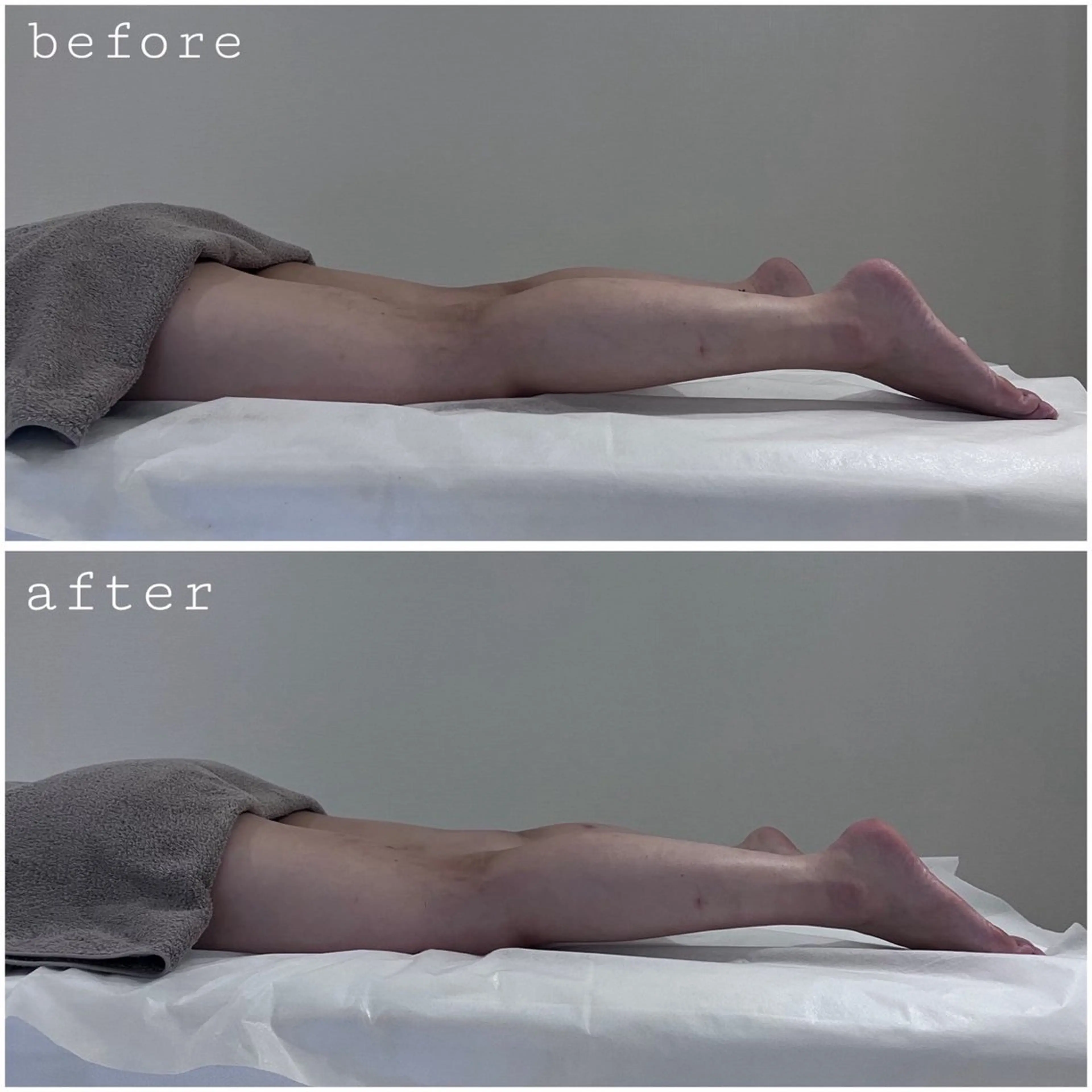 エステ Lib Charm 北本結愛のエステ・リラクイメージ